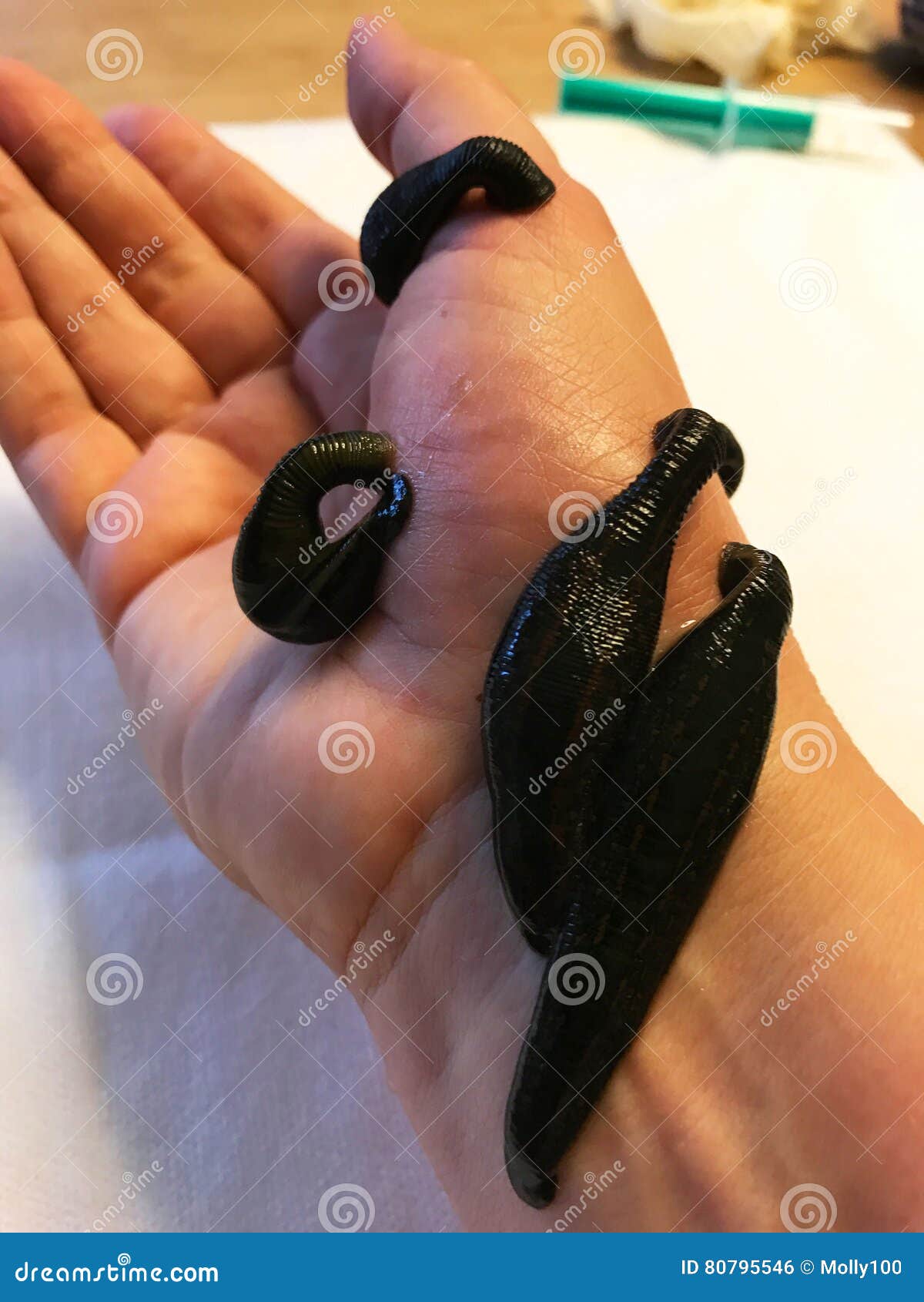 Leech Therapy on Hand for Osteoarthritis Stock Photo Image of