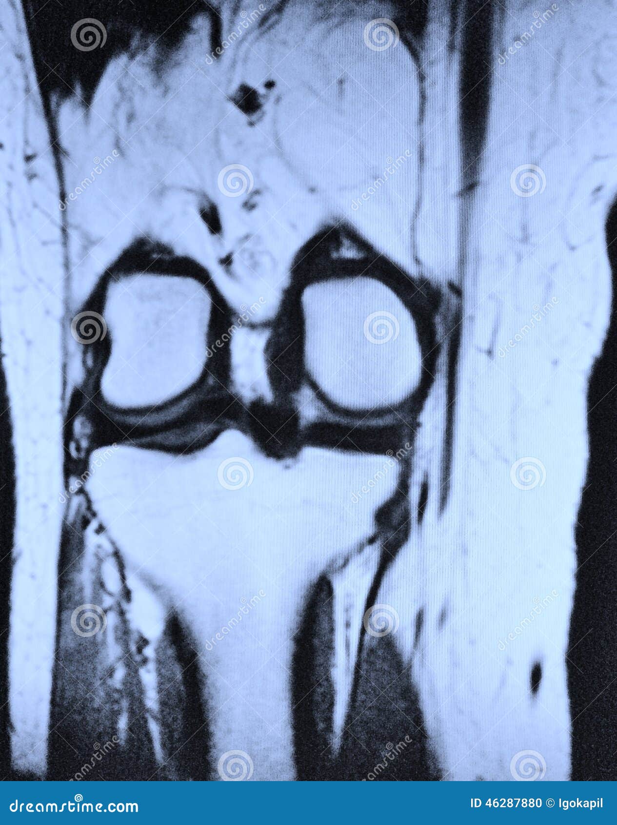 Left knee mri stock photo. Image of knee, structures - 46287880