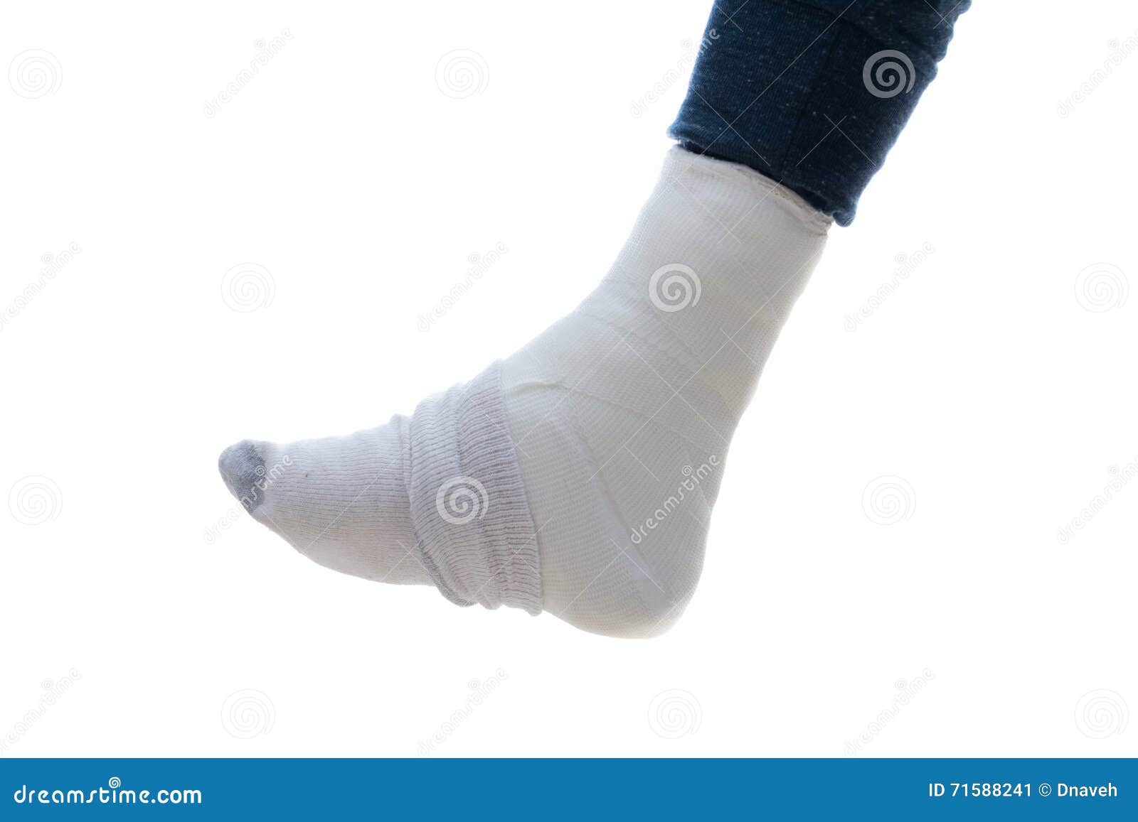 Leg Cast Covered with a Sock Stock Image Image of health, healthcare