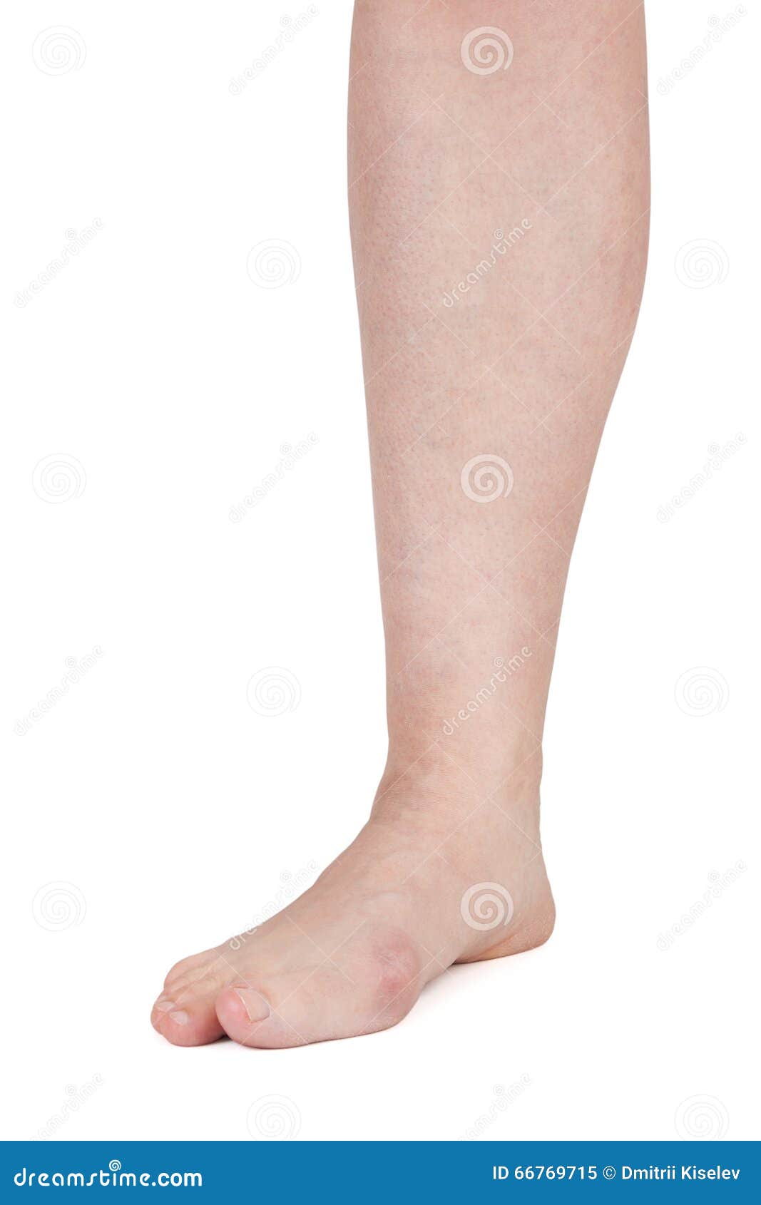 Leg with painful joints stock image. Image of body, anticnemion 66769715