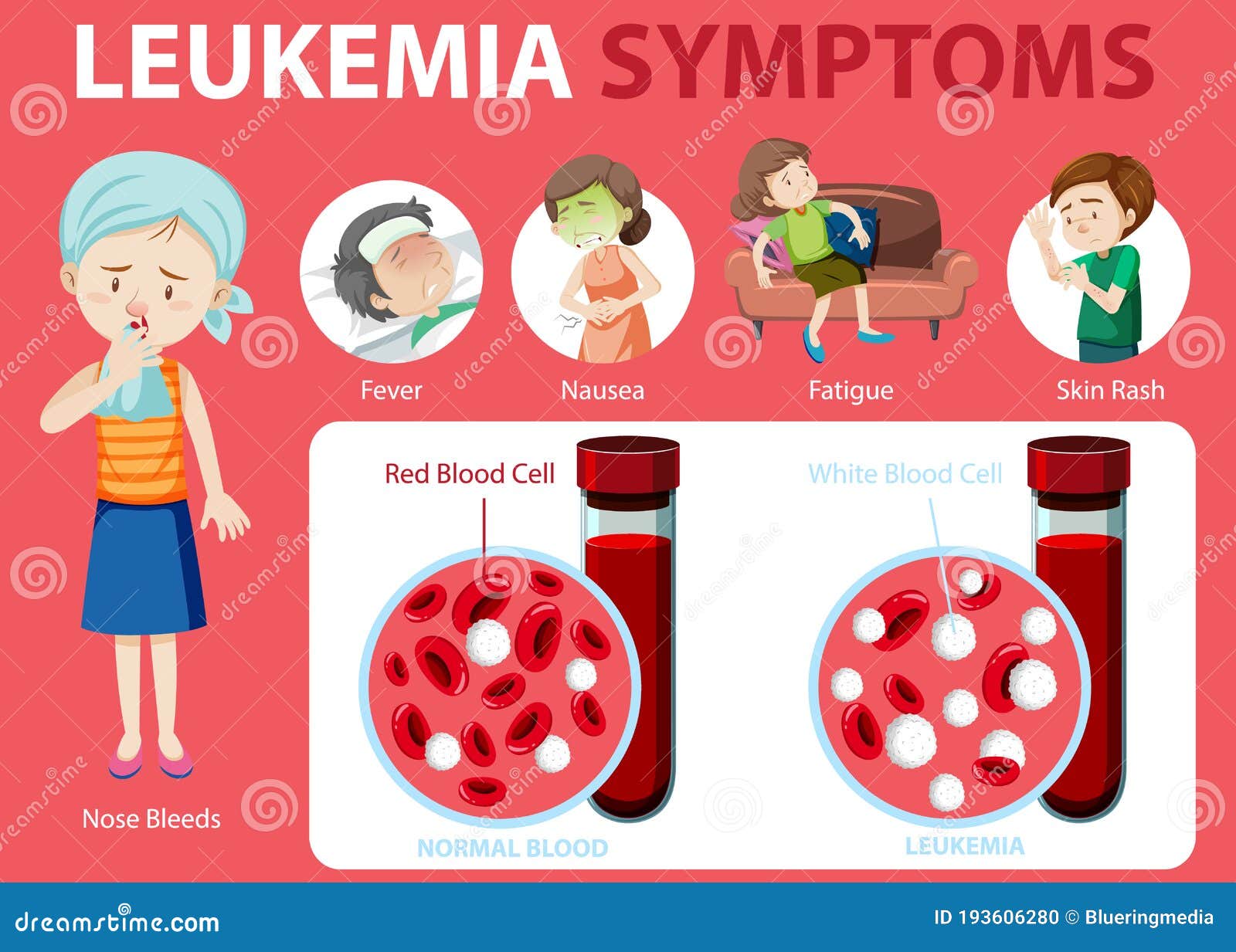 Leukemia Symptoms Cartoon Style Infographic Stock Vector Illustration