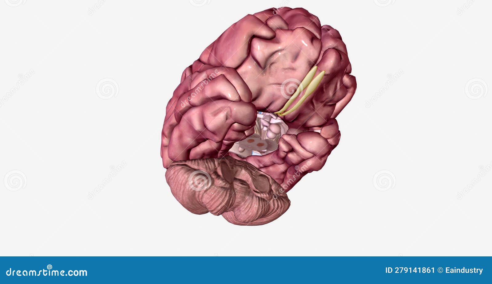 Lewy Body In Parkinson`s Disease PD Or Dementia LBD - Isometric 3d