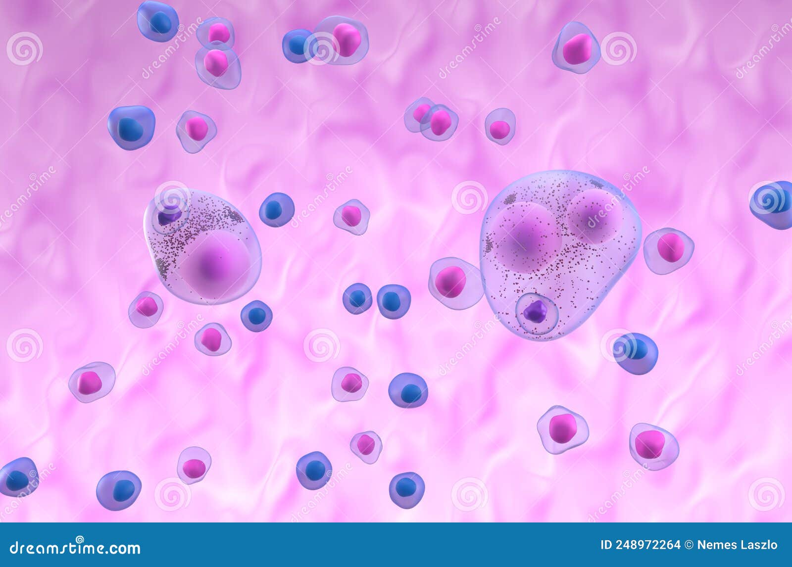 Lewy Bodies in Parkinson`s Disease PD or Dementia LBD - Isometric 3d