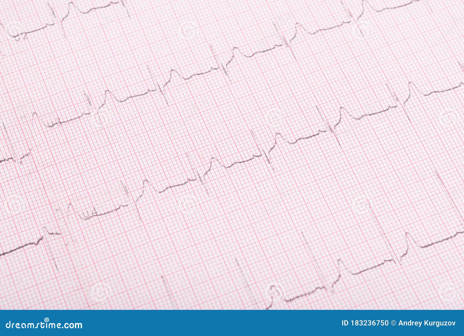 Light Heartbeat Cardiogram Background, Closeup Stock Photo Image of