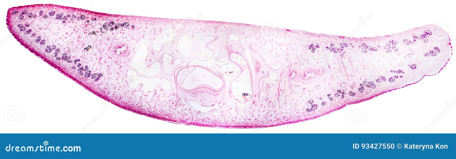 light micrograph of a liver fluke fasciola hepatica
