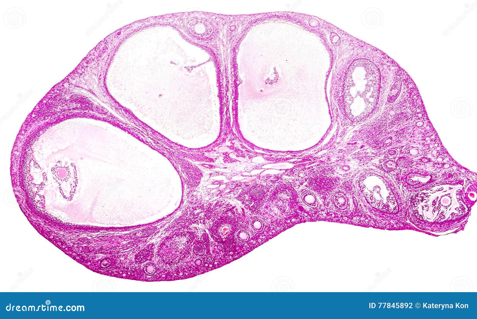 light micrograph of ovary