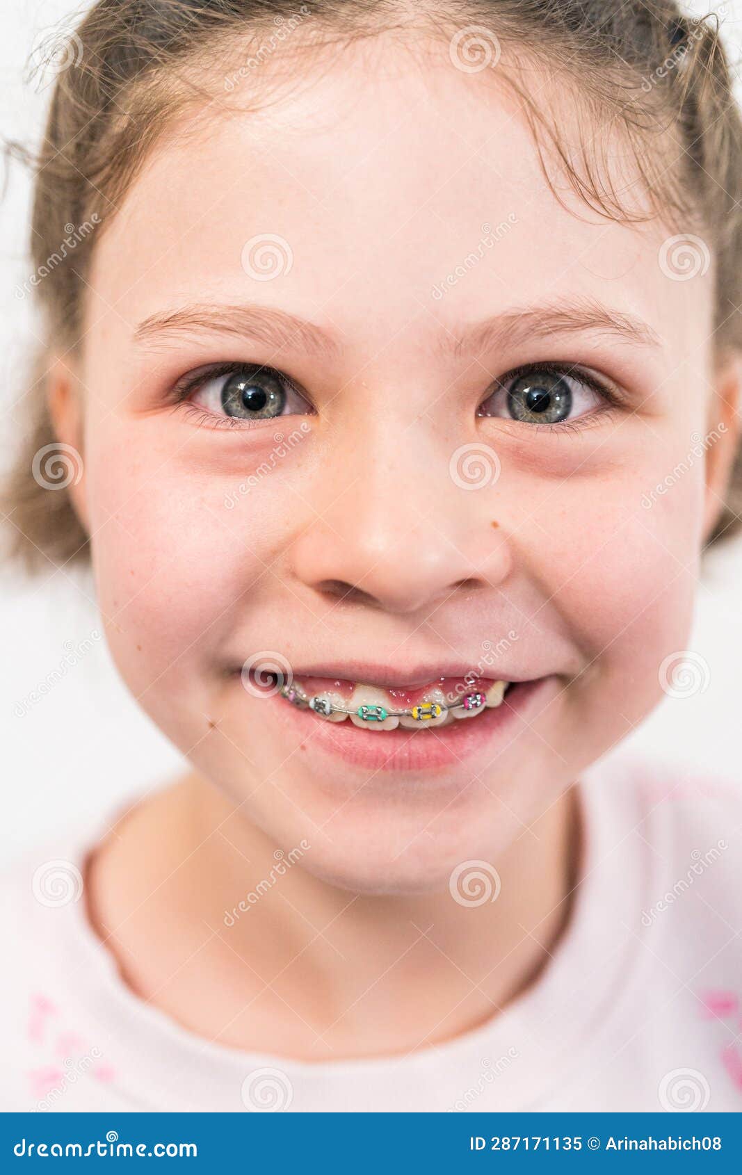Little Girl with Rainbow Braces Stock Image Image of teeth, face