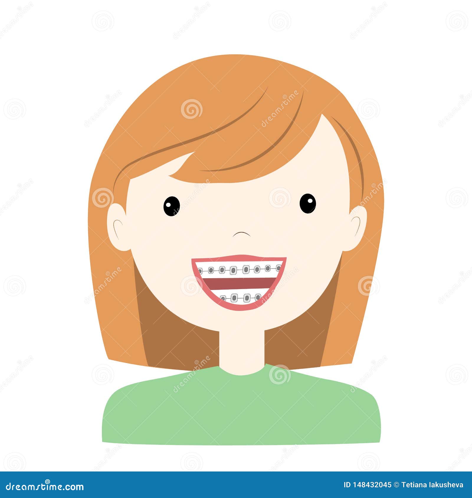 Little Girl Wearing Braces Tooth System. Vector Illustration Stock Vector -  Illustration of dentist, girlteen: 148432045