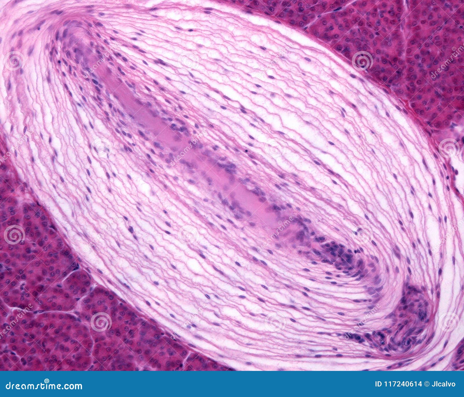 pacinian corpuscle