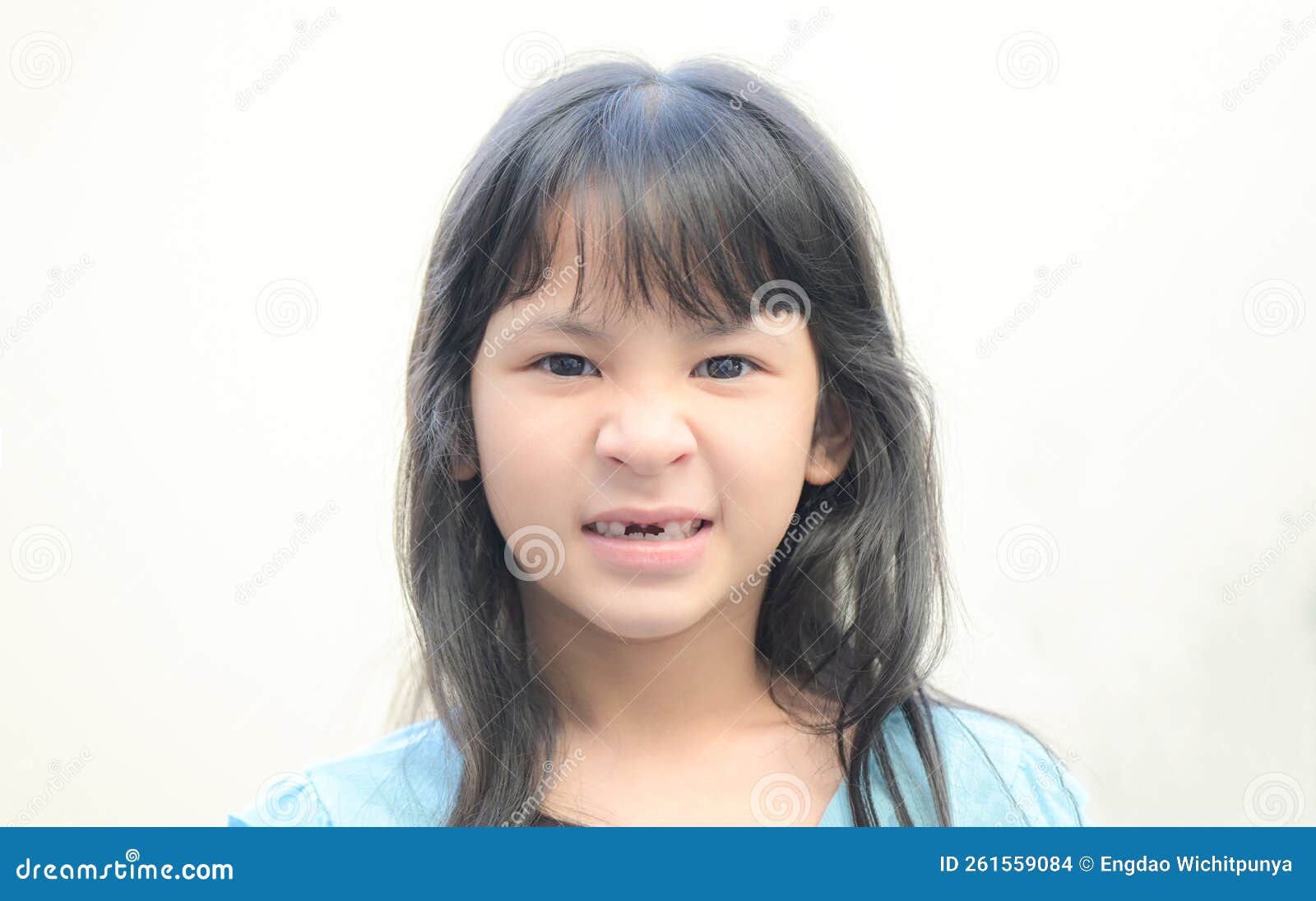 Lost Milk Teeth - Lost Baby Tooth , Smile Face of a Child Girl Baby