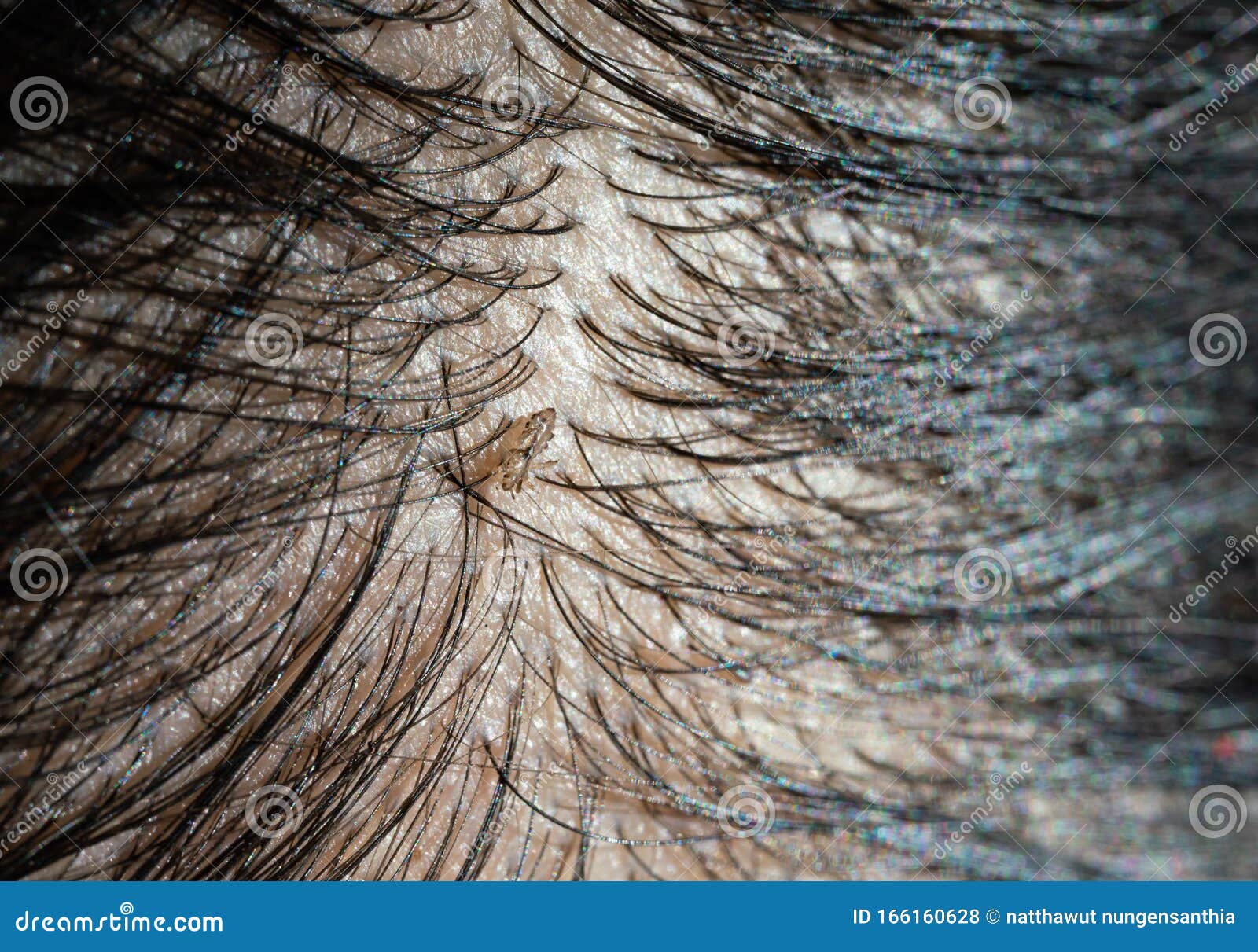 Human Louse Hair