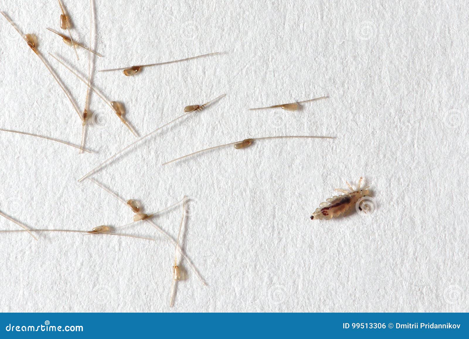 Louse and Nits Cocoons on White Paper Background Stock Photo Image of
