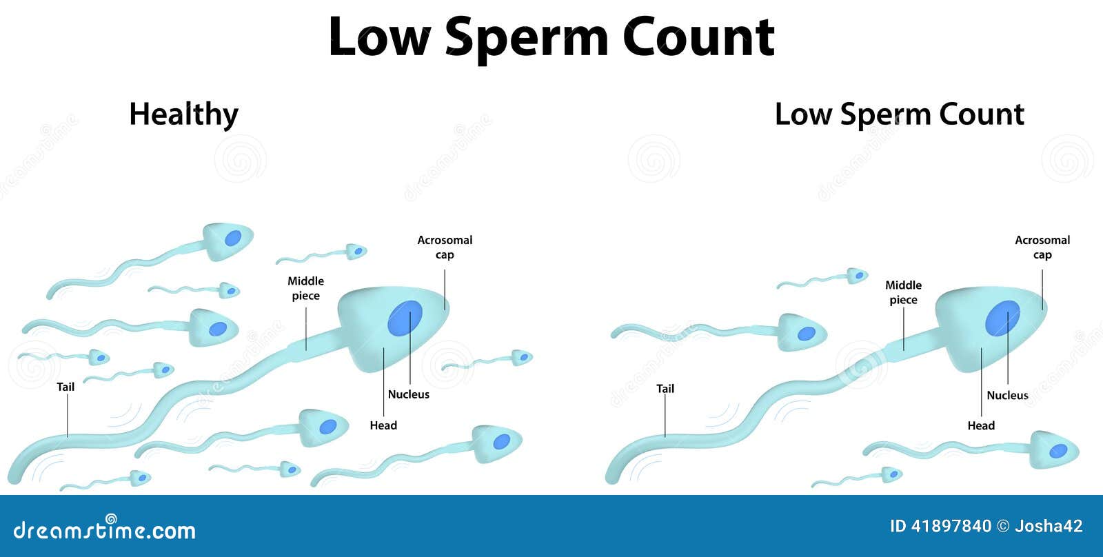 with paralysis person Low sperm in