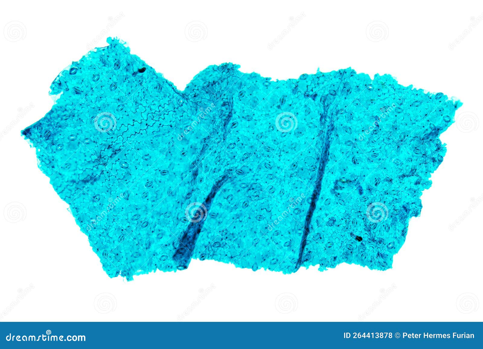 næve Glamour Udlevering Lower Epidermis of Broad Bean Leaf, Vivia Faba, 20X Light Micrograph Stock  Photo - Image of anatomy, background: 264413878