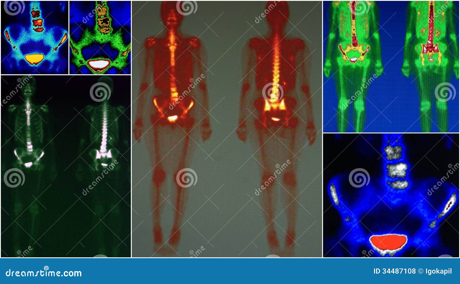 download a comparative