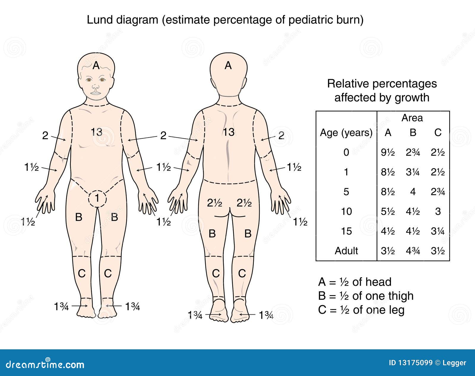 Burns Assessment Chart