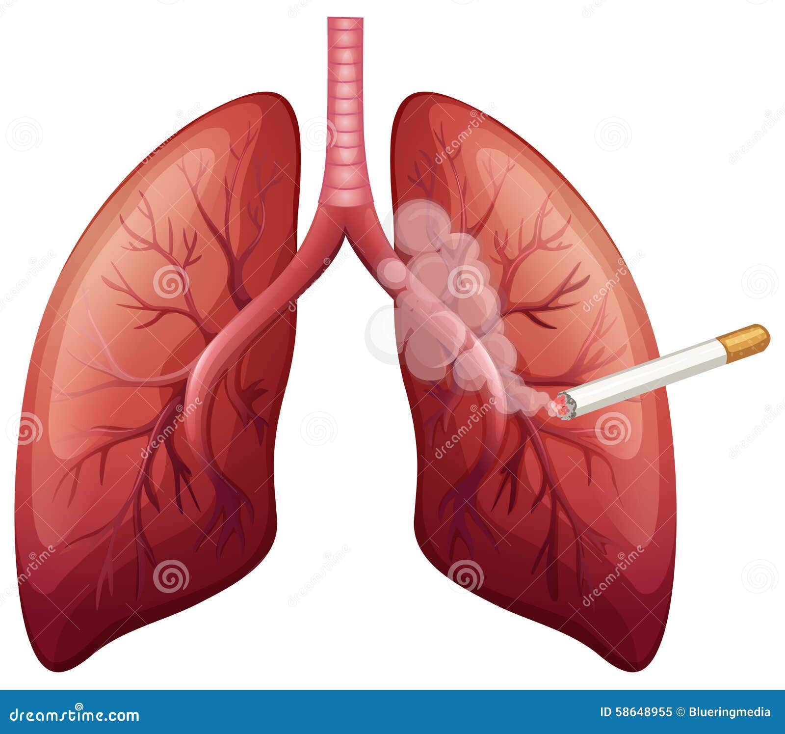 Lung cancer with smoke stock vector. Illustration of disease 58648955