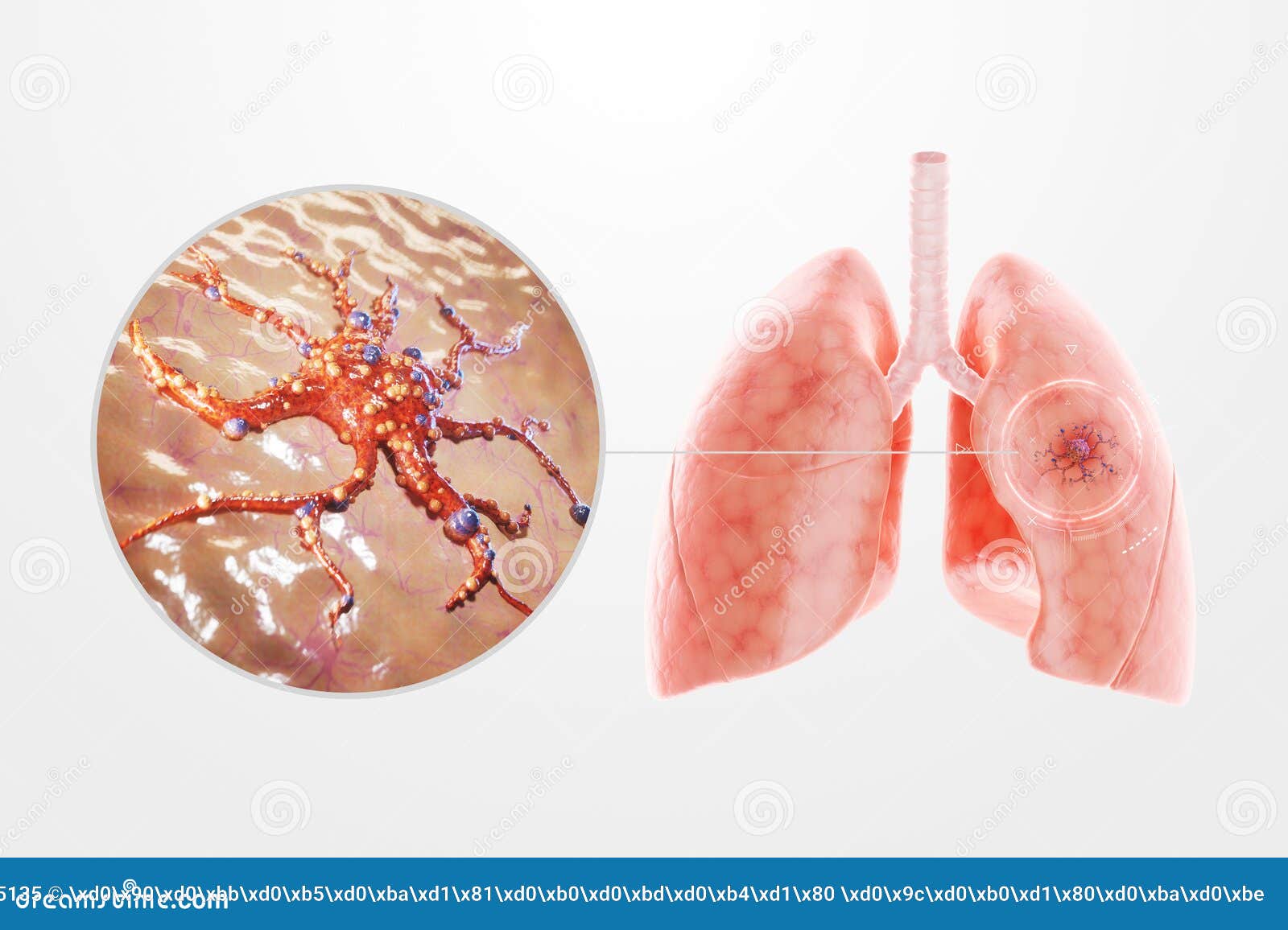 lung cancer, tumor, human anatomy, disease. concept of health care, medicine, biology. 3d render, 3d , copy space,