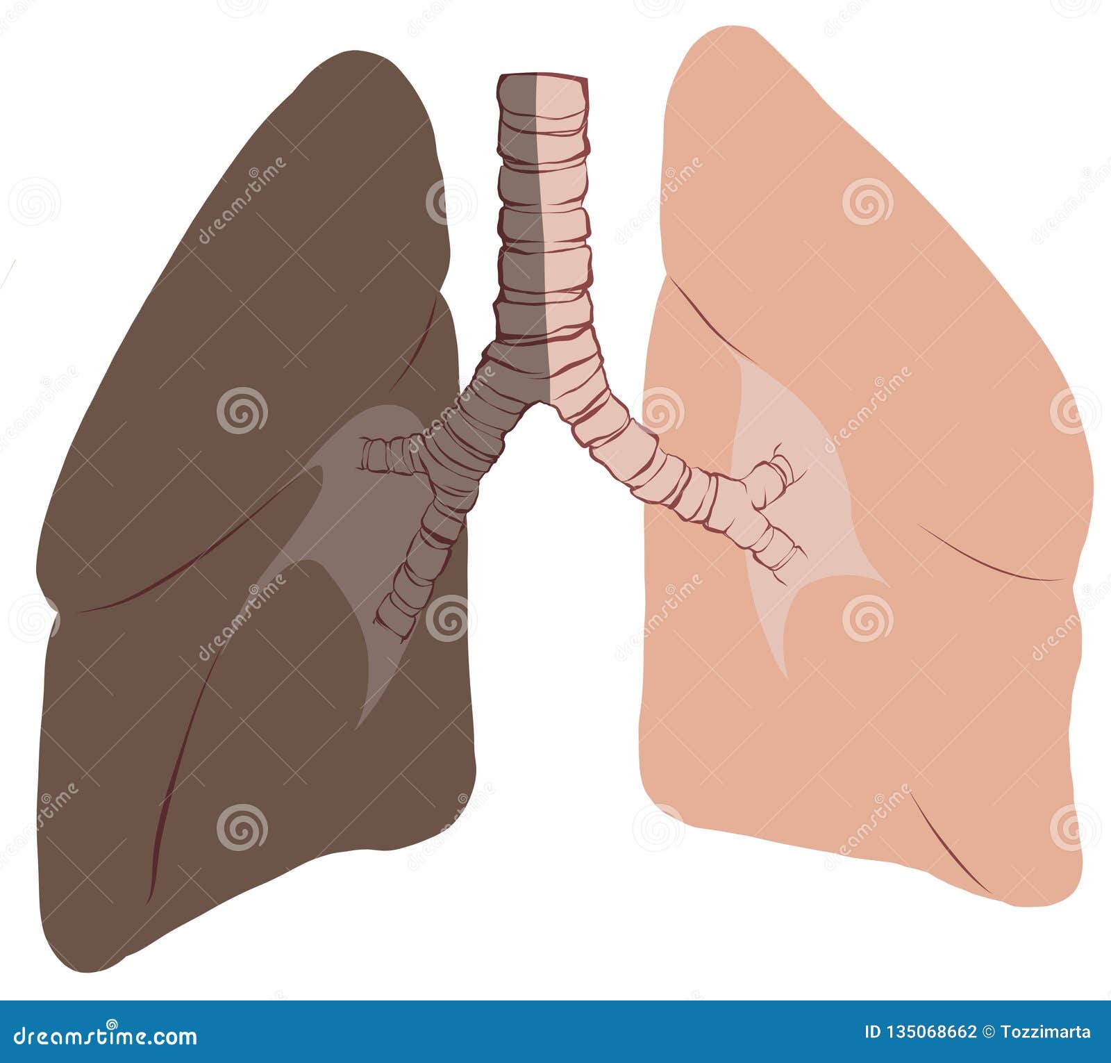 Lungs and trachea cancer stock photo. Illustration of pulmonary 135068662