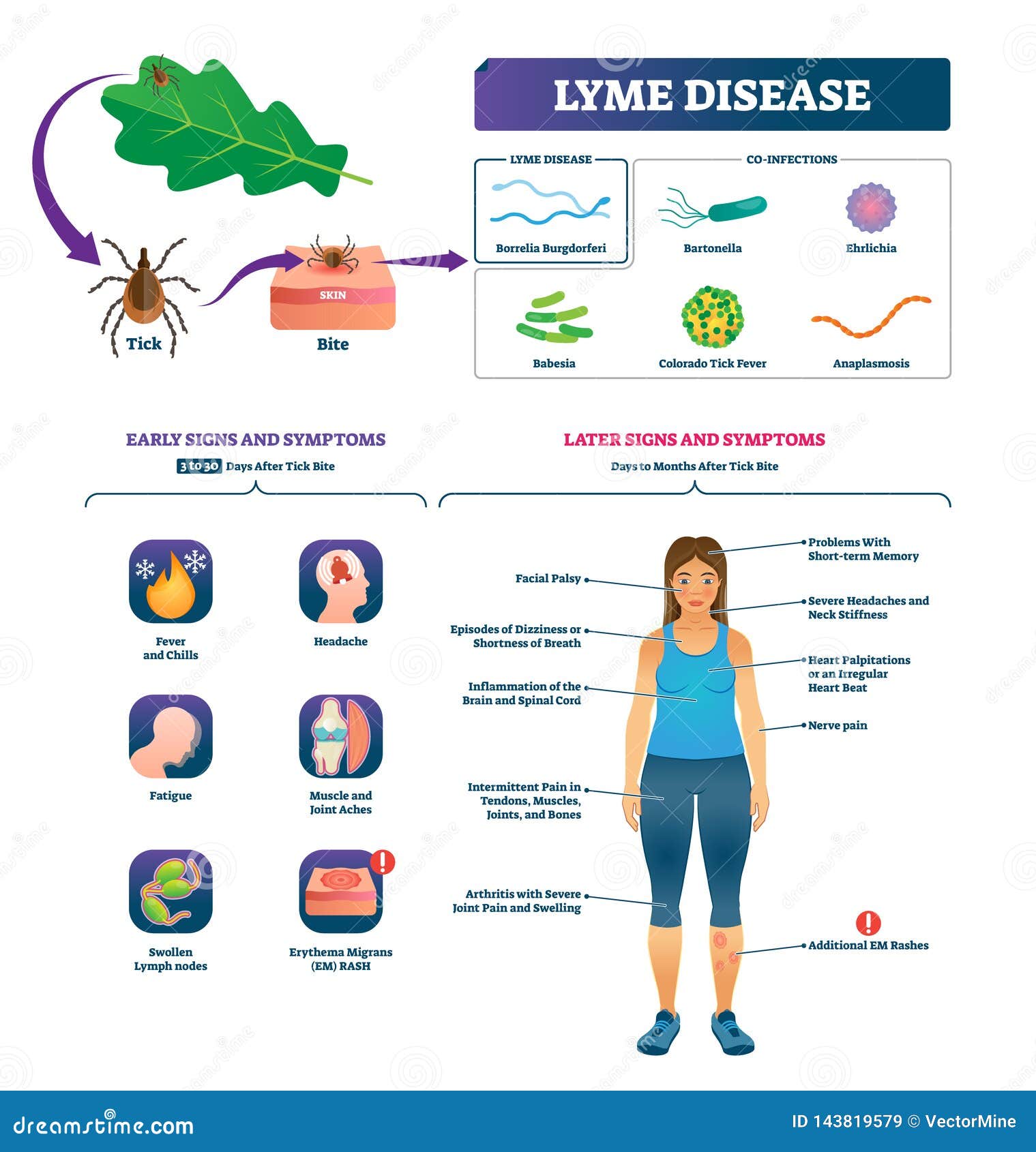 Lyme Disease Vector Illustration Labeled Tick Bite Infection Symptoms