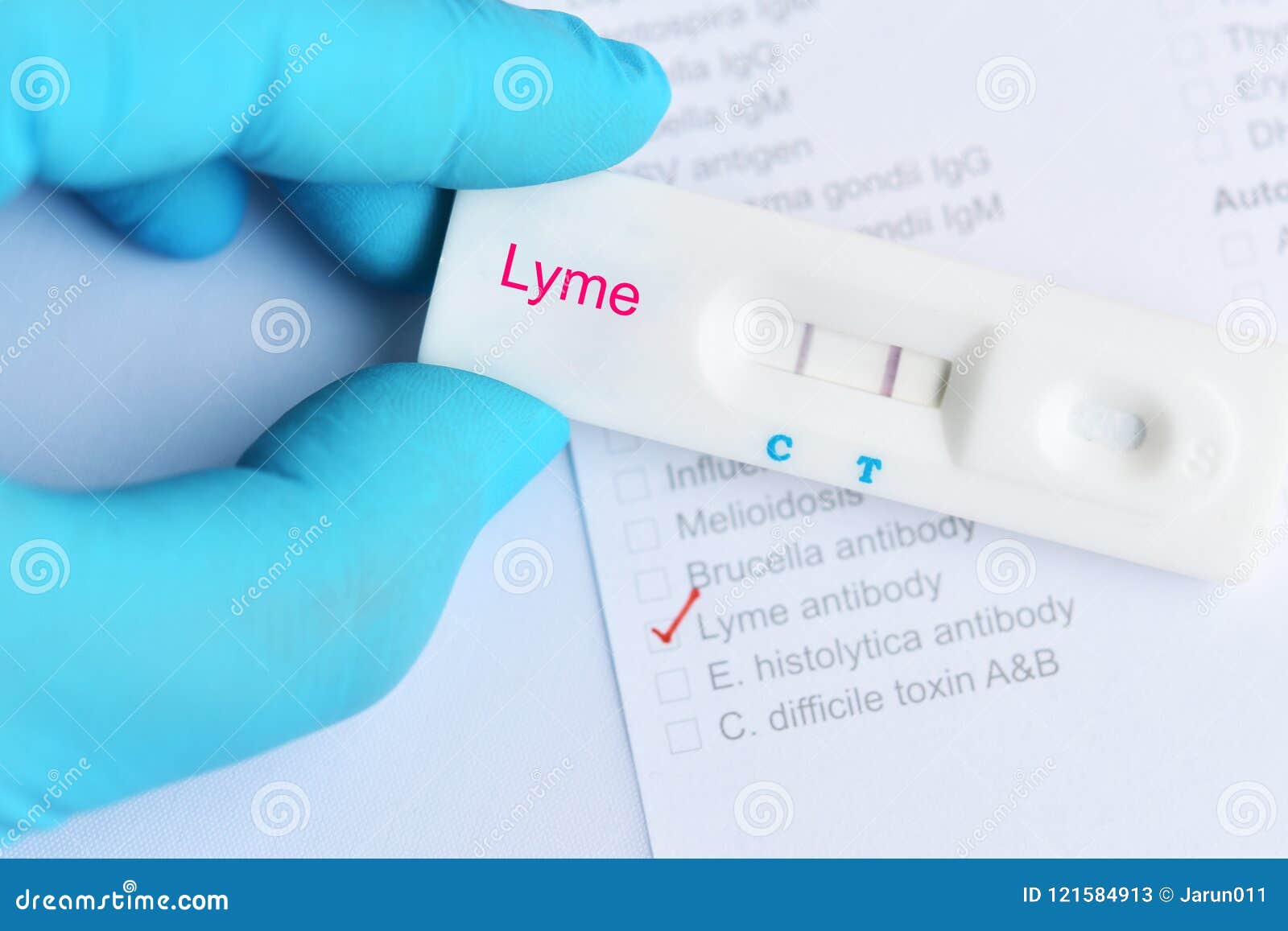 Lyme positive test result stock image. Image of biology 121584913 Lyme positive test result stock image. Image of biology 121584913