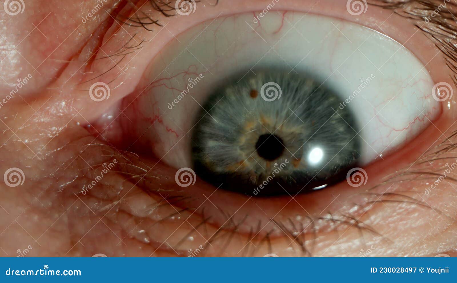 MACRO Opened Bulging Human Eye, Close Shot Stock Image Image of