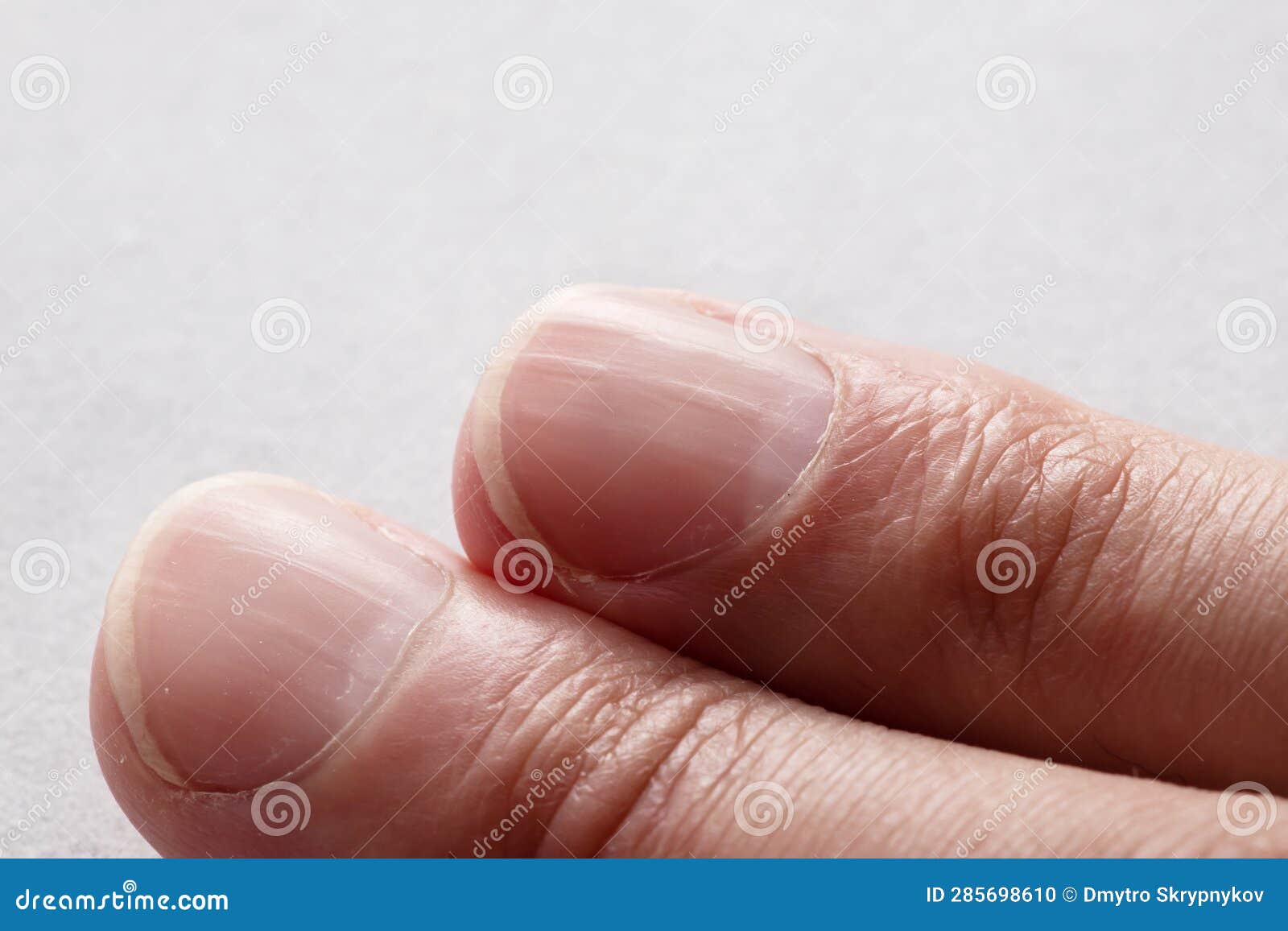 Macro Photo of Vertical Ridges in Fingernails Stock Photo Image of