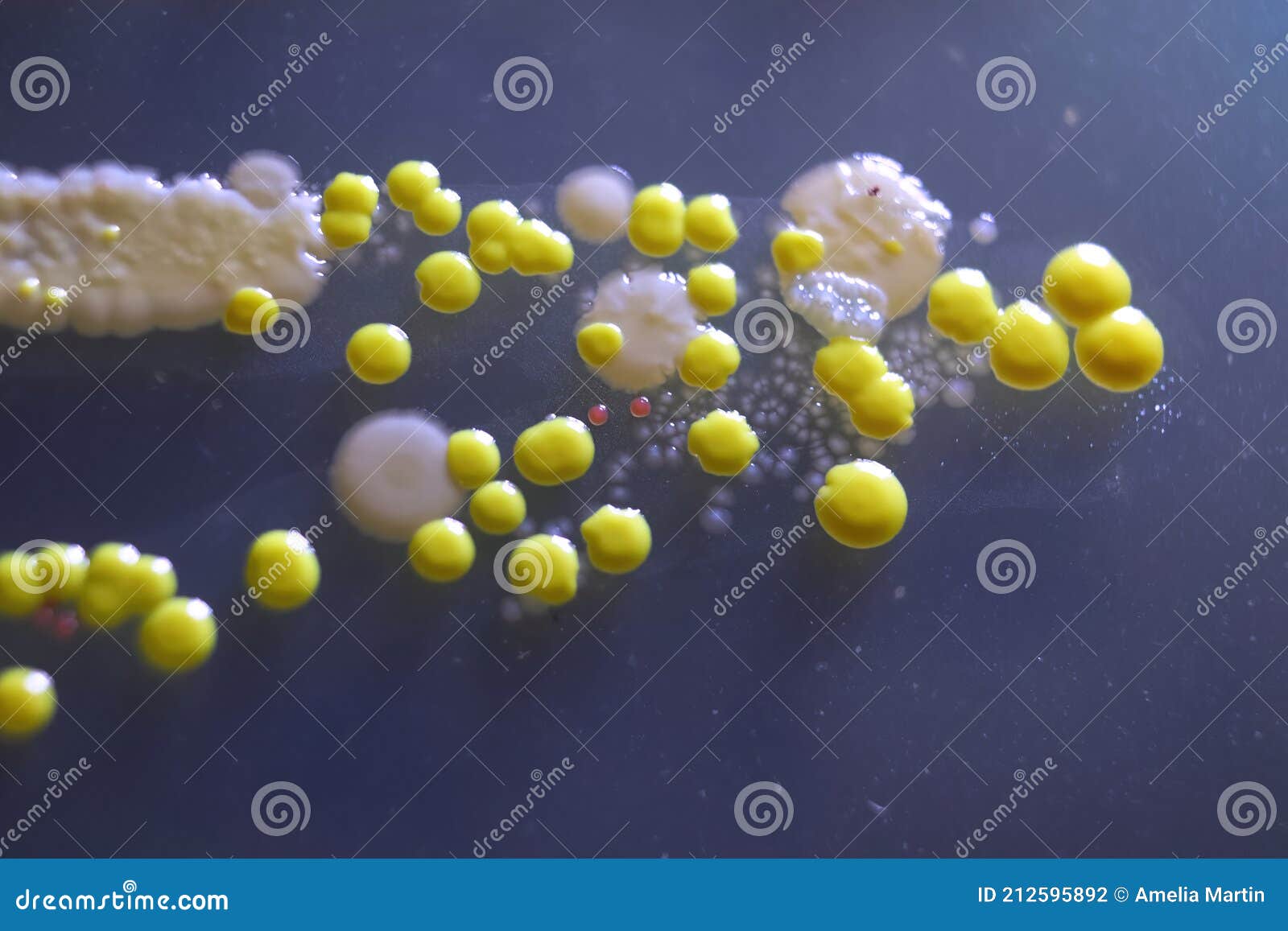 Macro View of Bacteria and Baker Yeast Colonies Stock Photo Image of