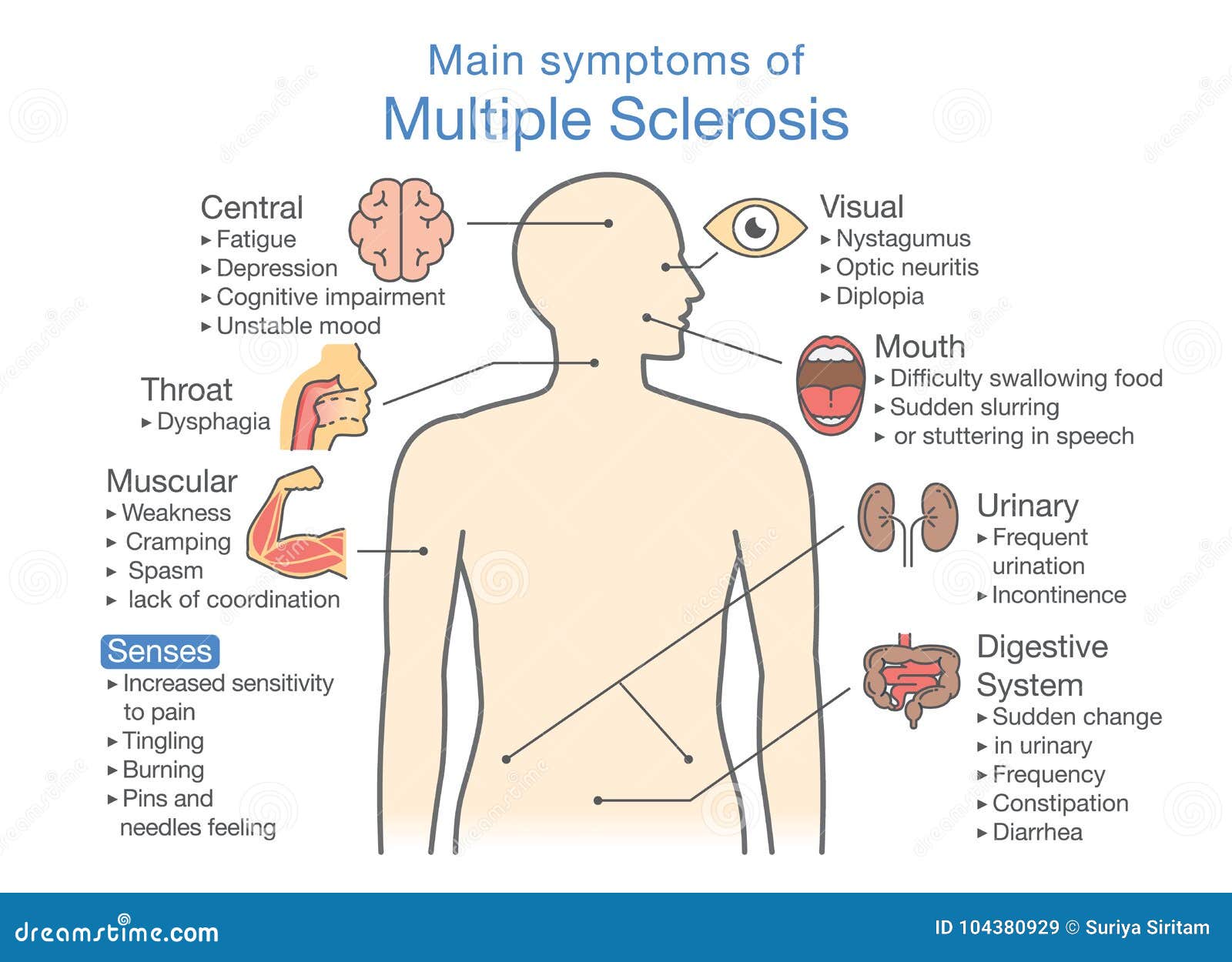 first signs of multiple sclerosis