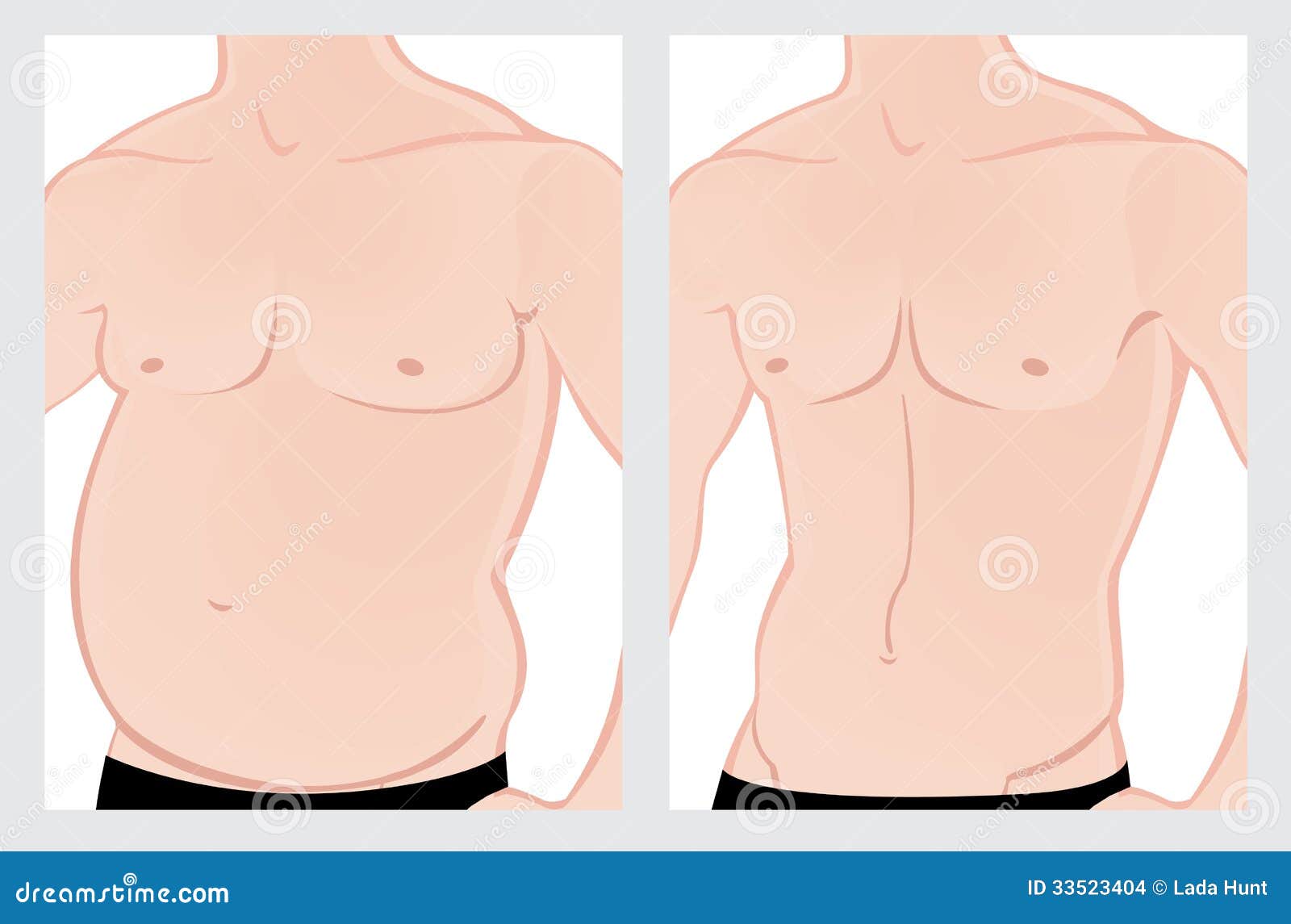 male abdomen before and after treatment