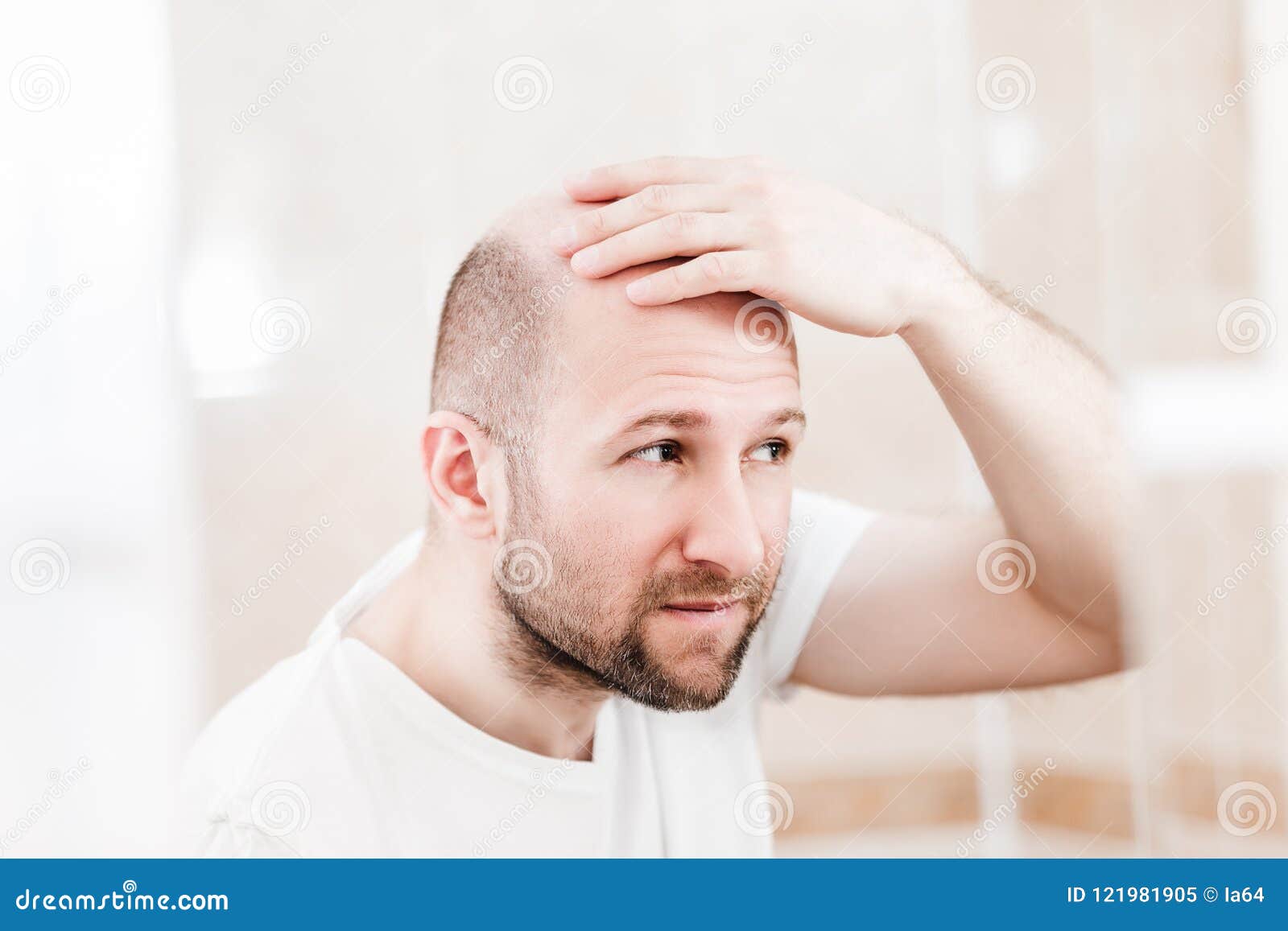 bald man looking mirror at head baldness and hair loss