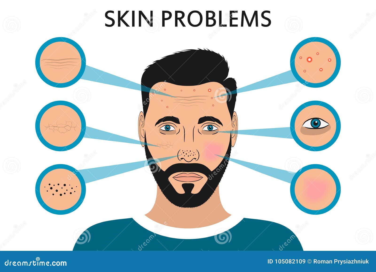 male face skin problems. acne and pimples, black spots, redness, dryness, circles under the eyes and wrinkles. .