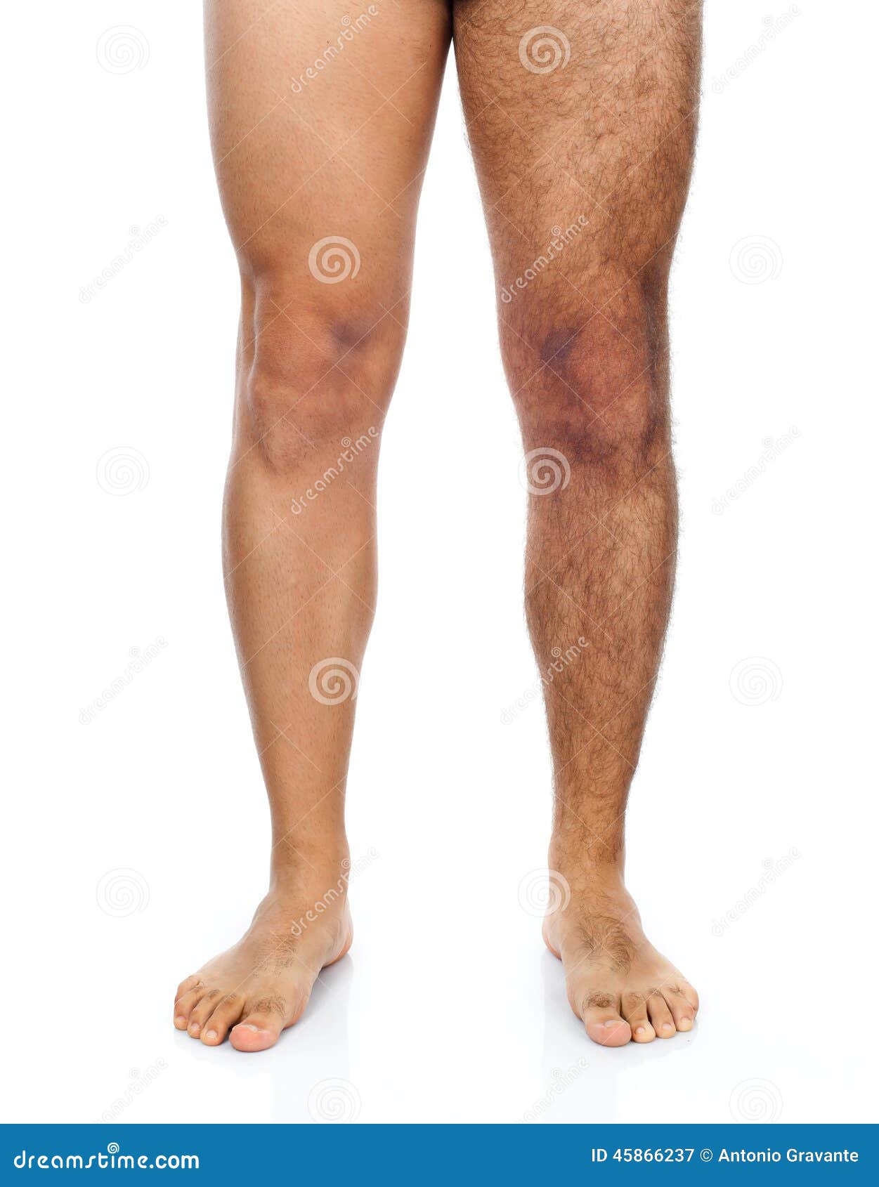 Male hair removal on legs stock image. Image of caucasian - 45866237