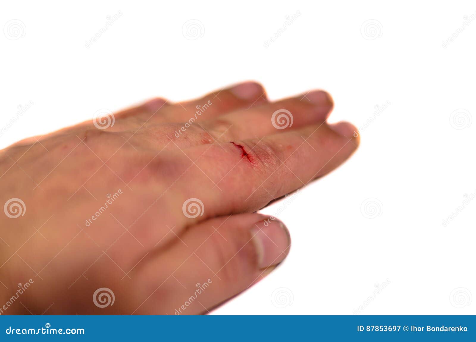Male Hand with Bleeding Finger Isolated on White Background Stock Image
