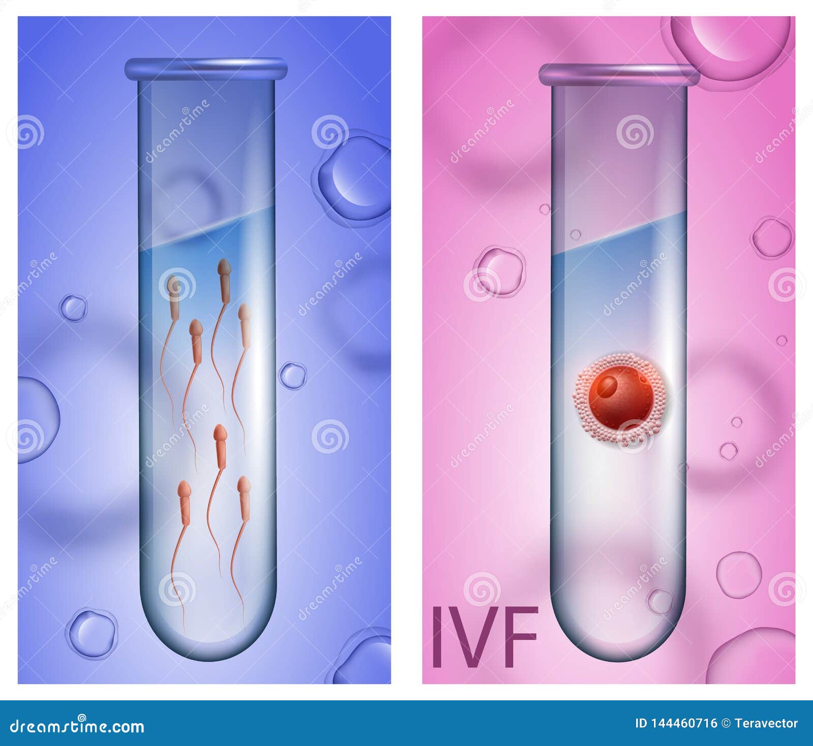 Best of Boy sperm catcher tube catcher tube sperm Boy