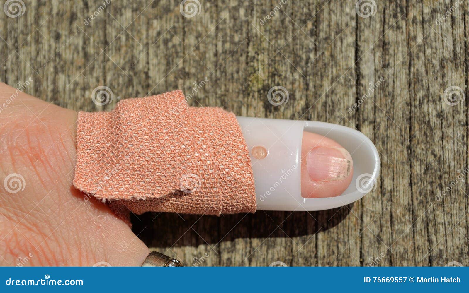 Mallet Finger Splint stock image. Image of medical, healthcare 76669557