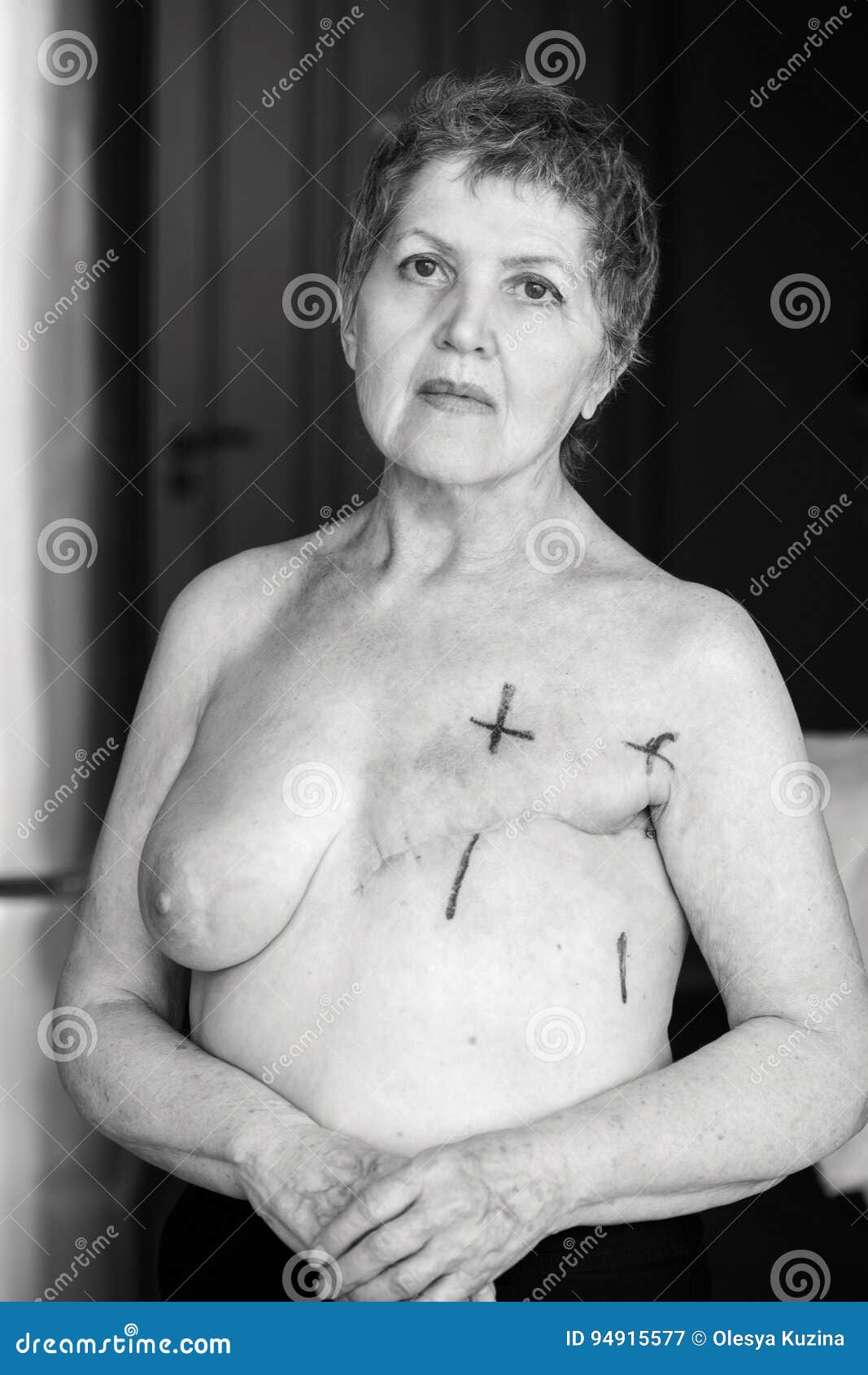 женщины с ампутированными грудями фото фото 72