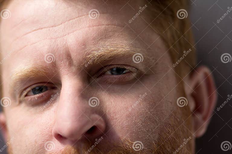 7. The Health Risks Associated with Ginger Hair and Blue Eyes - wide 6