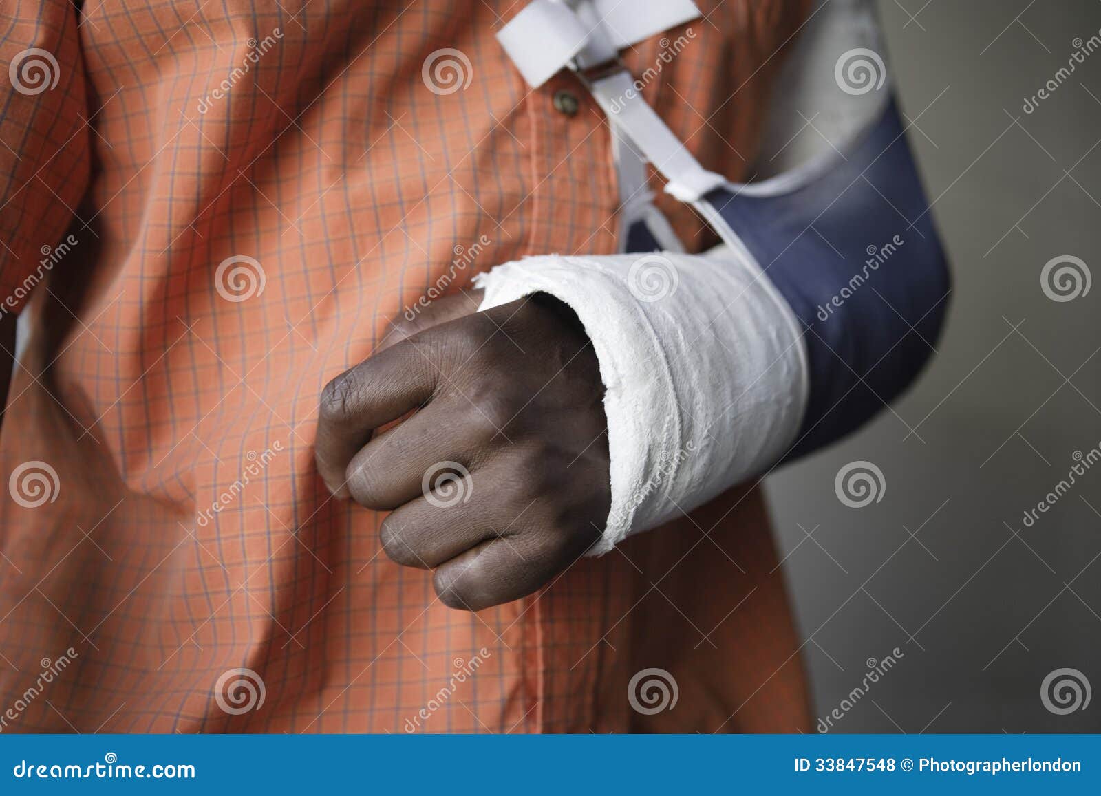 man with broken arm in cast