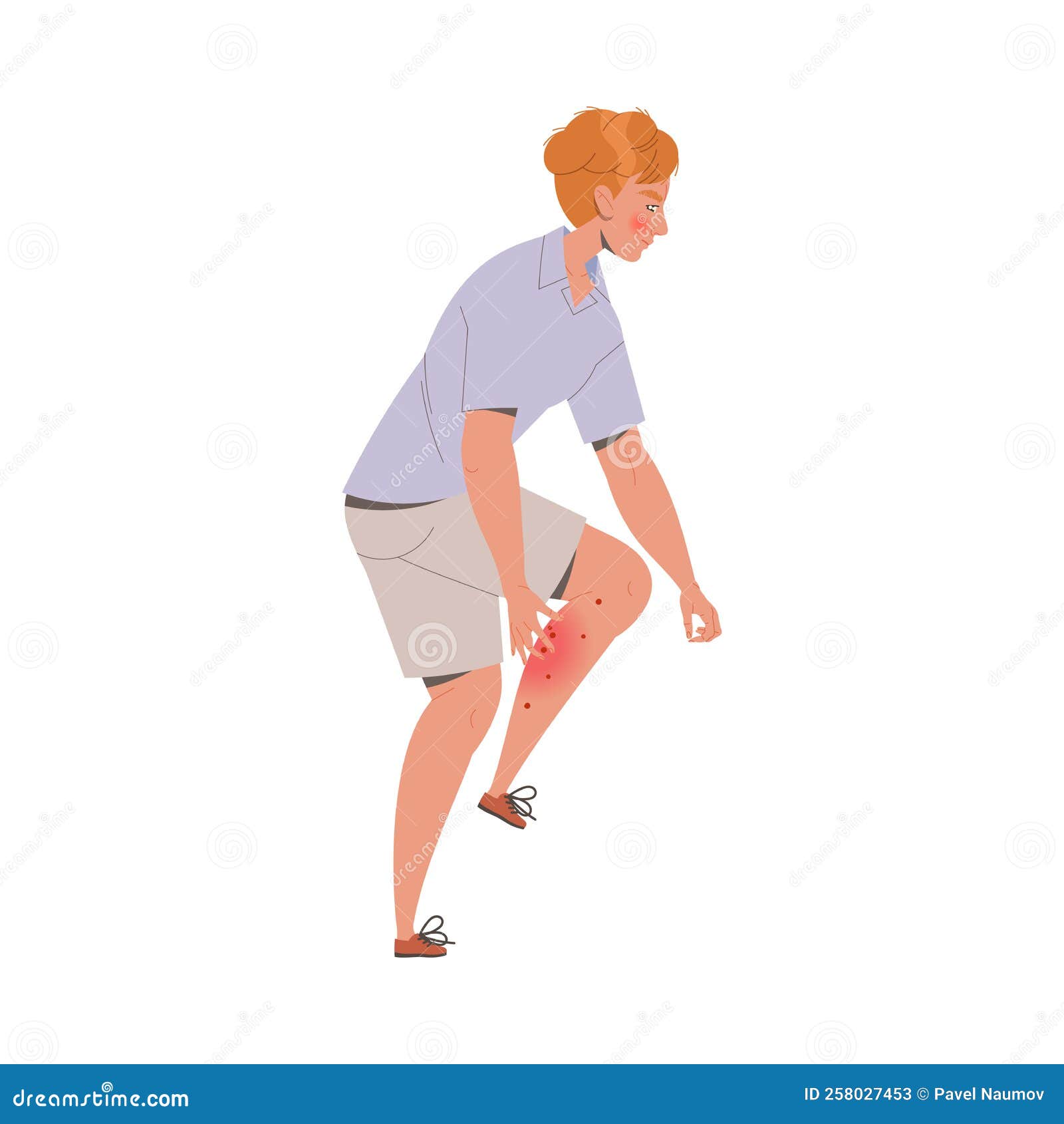 man character itching and rubbing skin on his leg suffering from neurodermatitis  