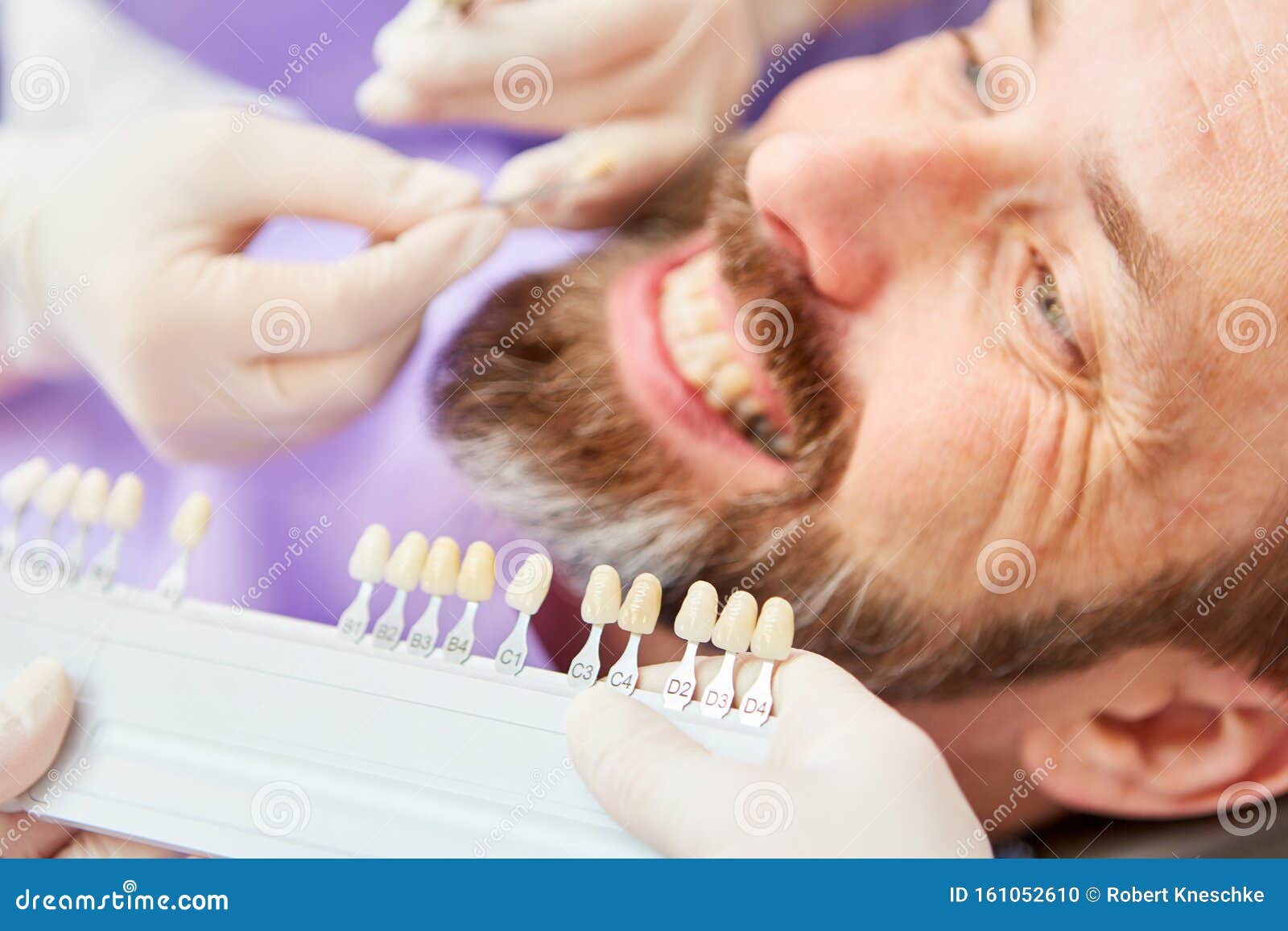 Man at the Dentist Adjusting the Tooth Color Stock Photo Image of
