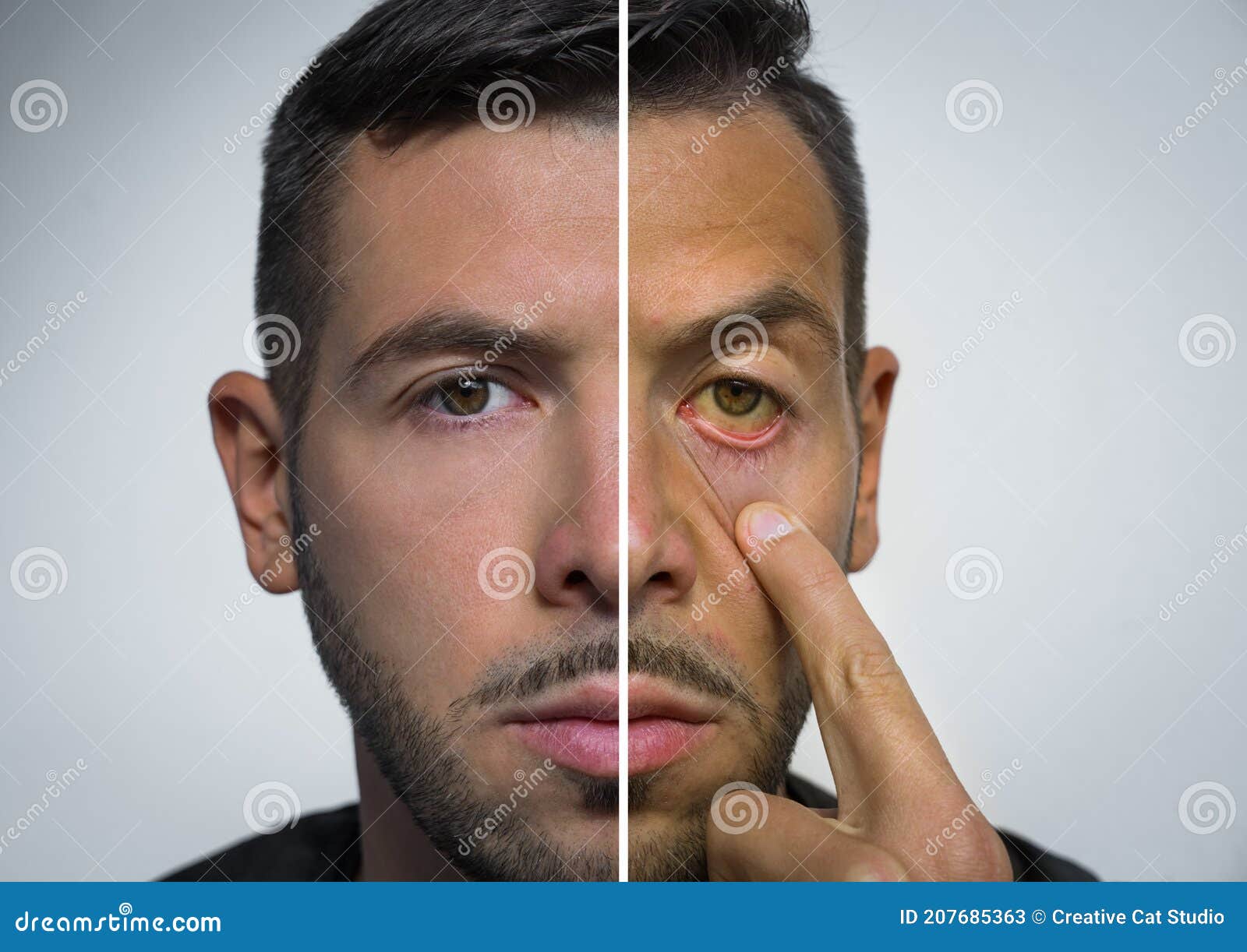 Man Face Divided into Two Parts One Healthy and One Unhealthy. Alcohol