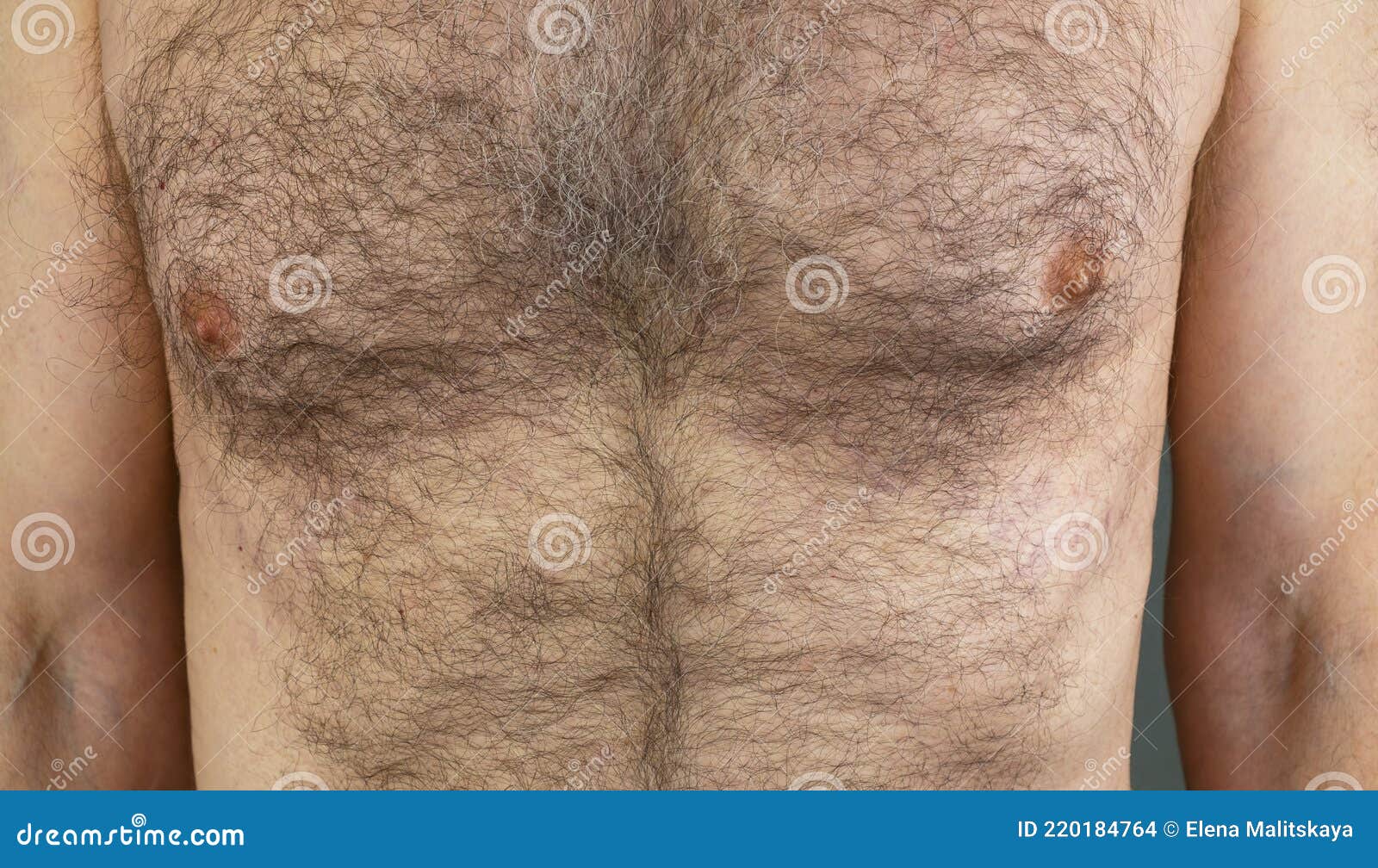 A Man with a Hairy Male Breast Close-up Stock Photo - Image of human,  detail: 220184764