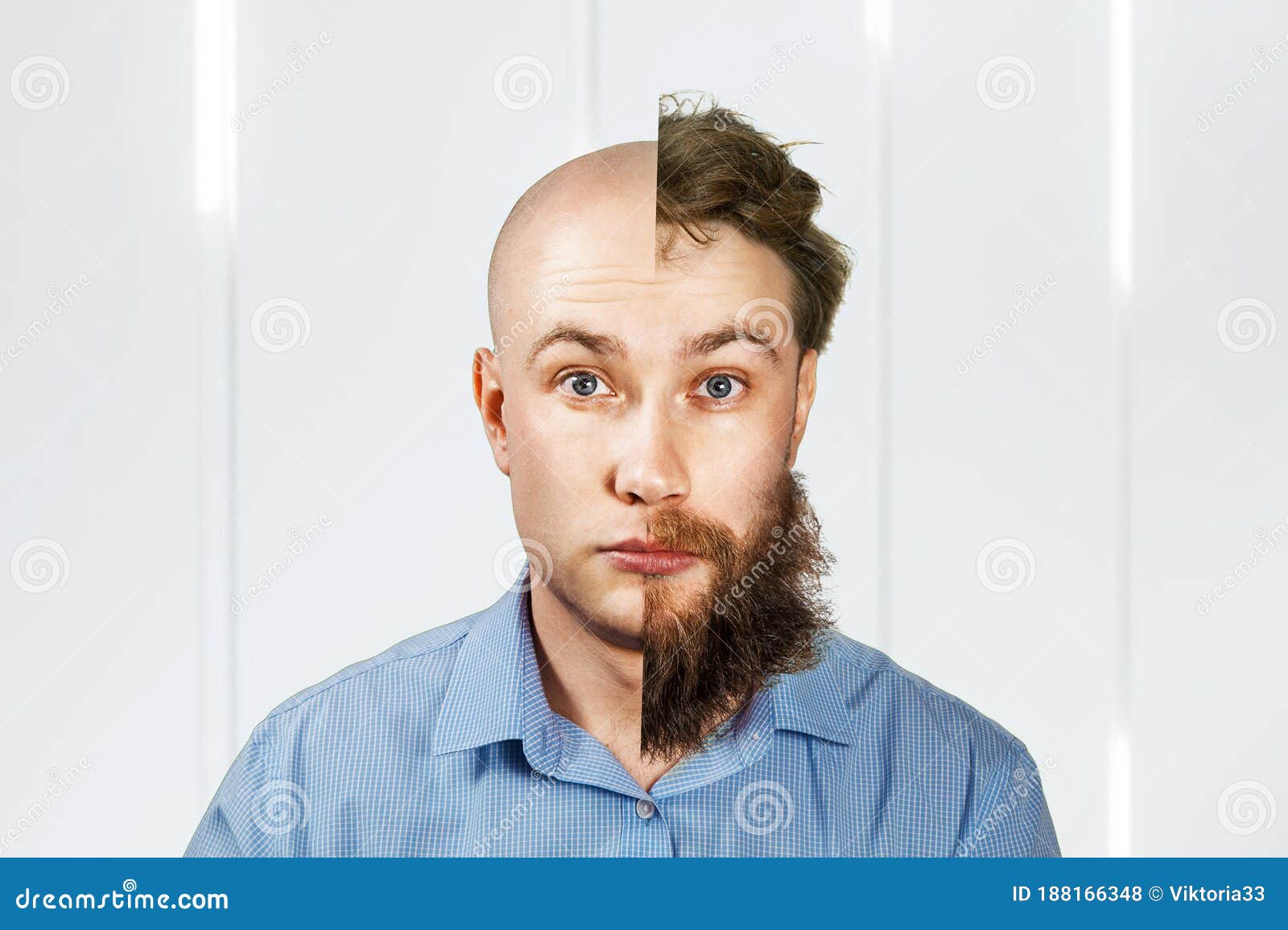 Man with Half Shaved Beard and Hair Head. Guy before and after Transplant  and Alopecia Stock Photo - Image of isolated, barber: 188166348