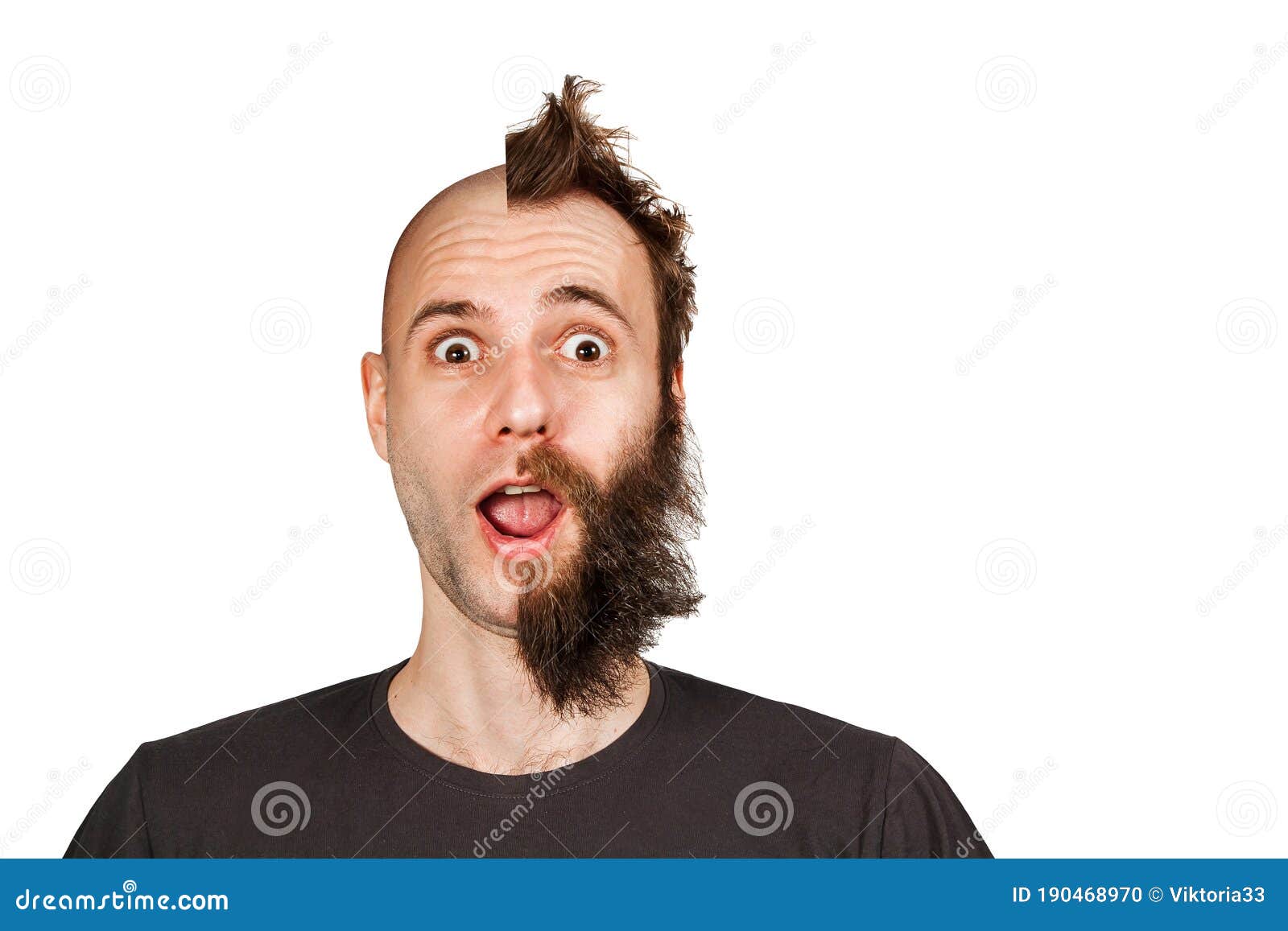 Man With Half Shaved Hair Head Guy Before And After Transplant And Alopecia Isolated On White Stock Photo Image Of Hairy Face