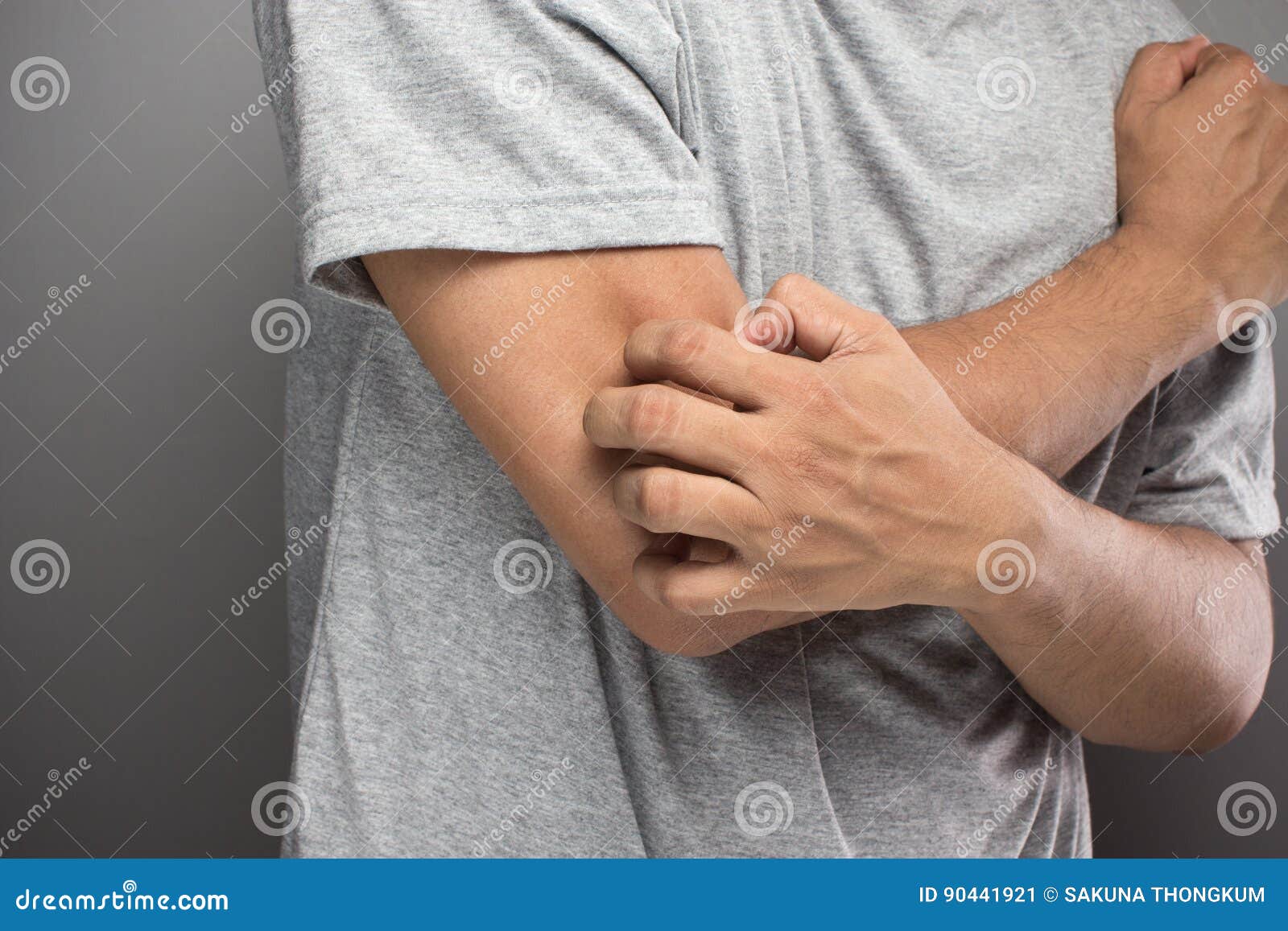 cashew allergic reaction symptoms cashew allergic reaction symptoms