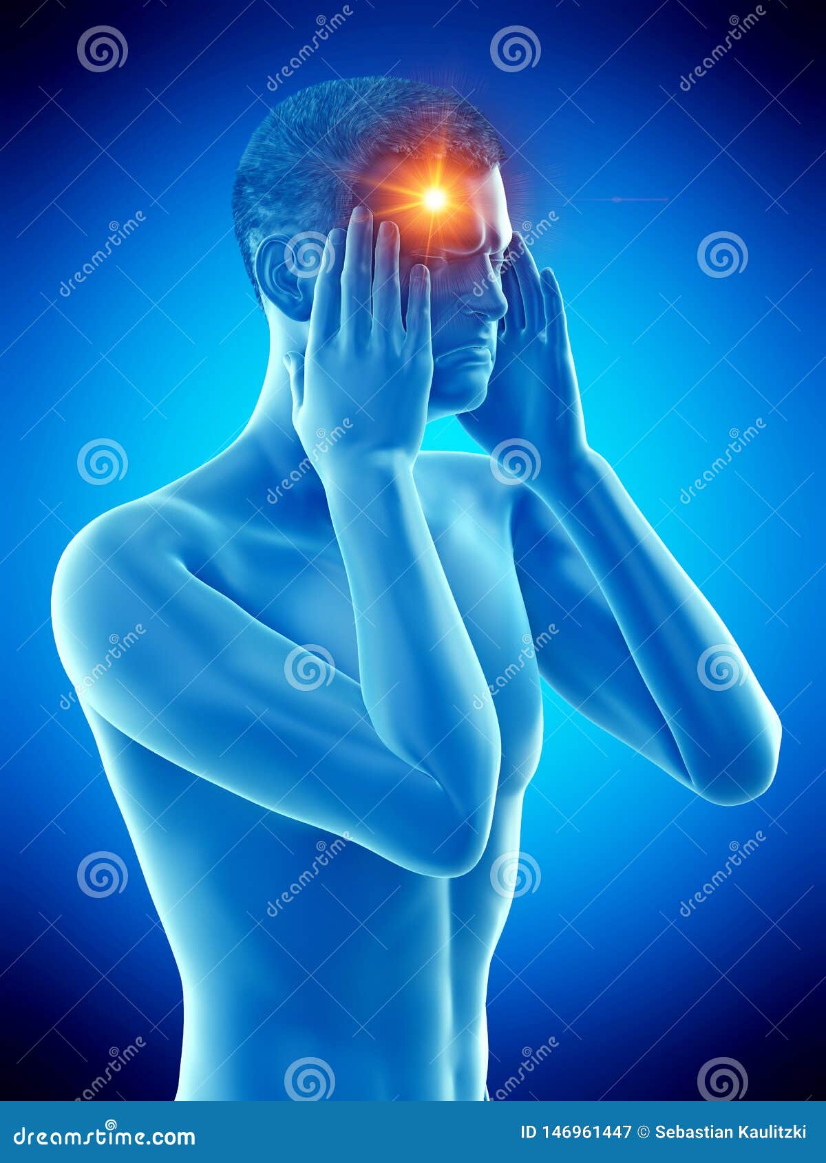 a man having a cluster headache