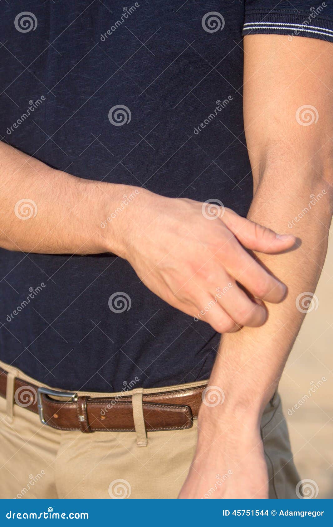 Man having a skin allergy stock photo. Image of allergy 45751544