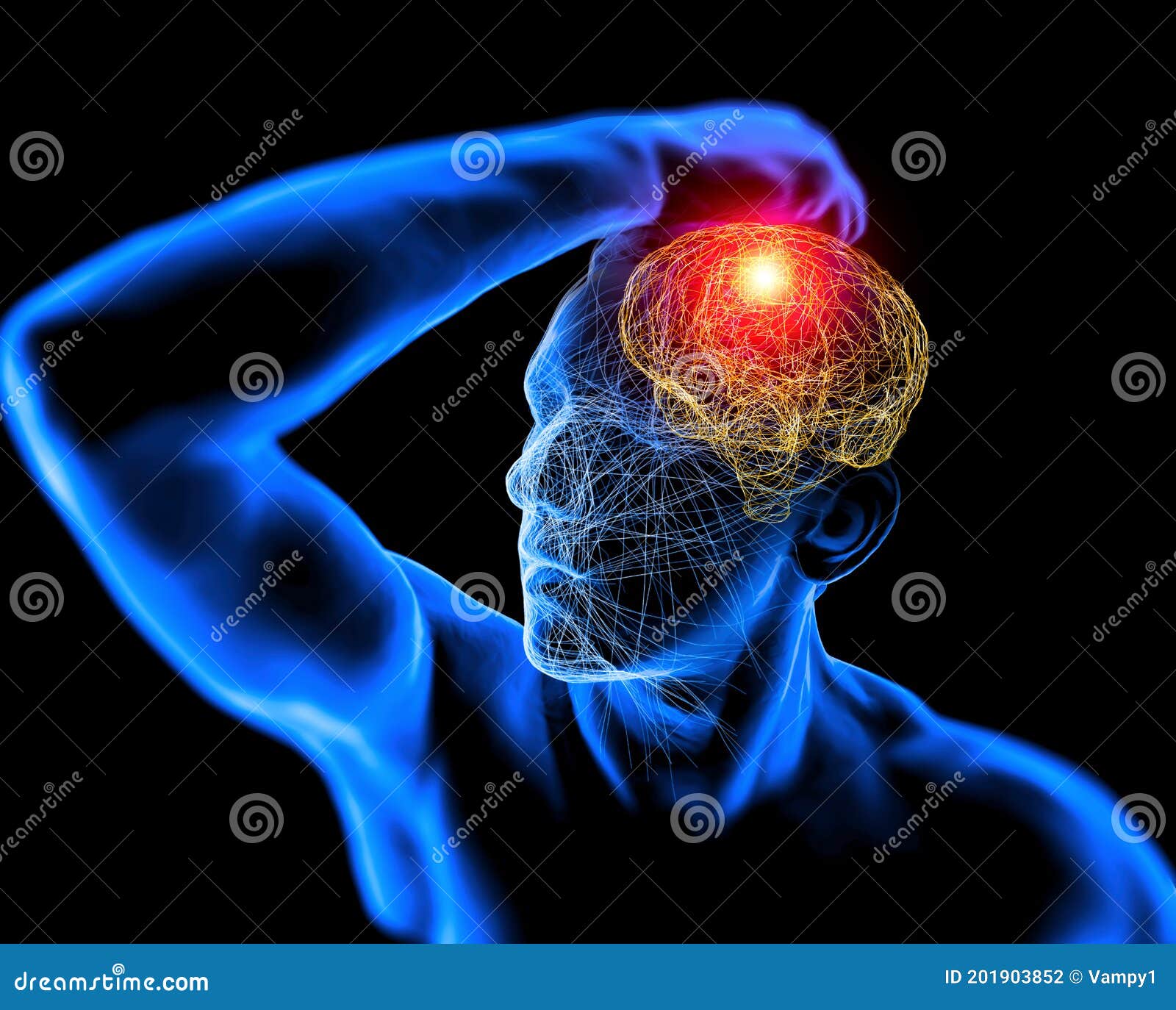 man with headache, pain in the back of the head