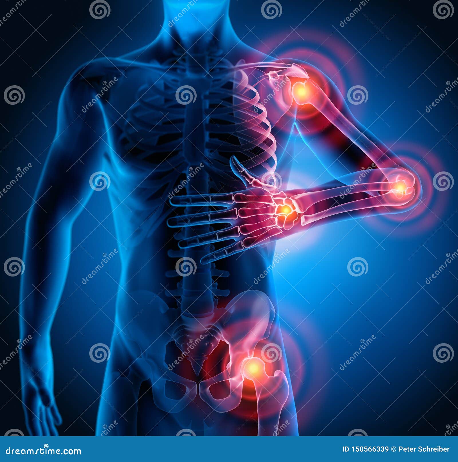 man with heavy joint pain symptoms
